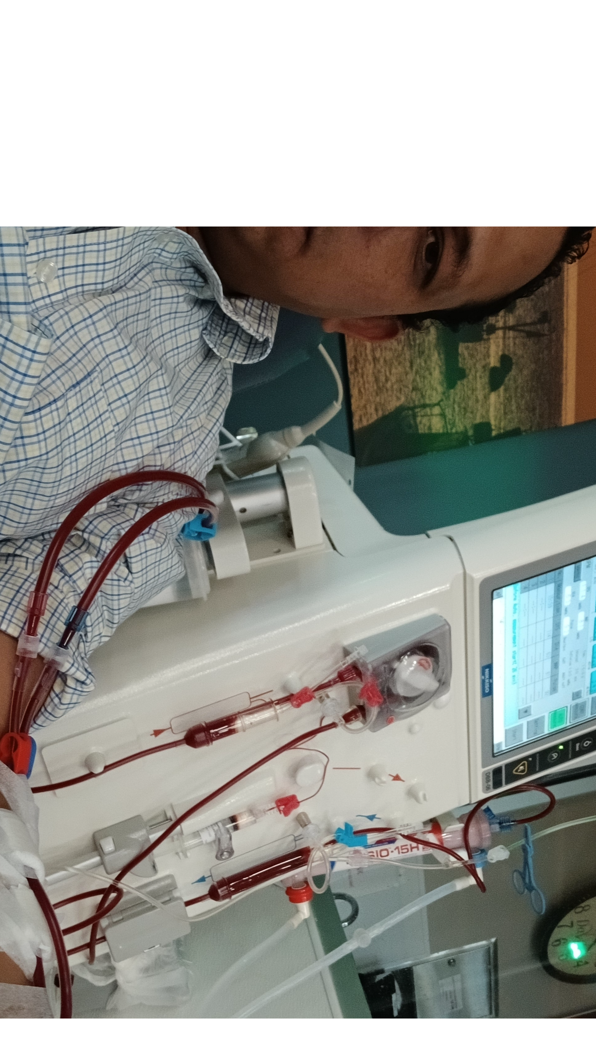 make my dream of a kidney transplant come true photo