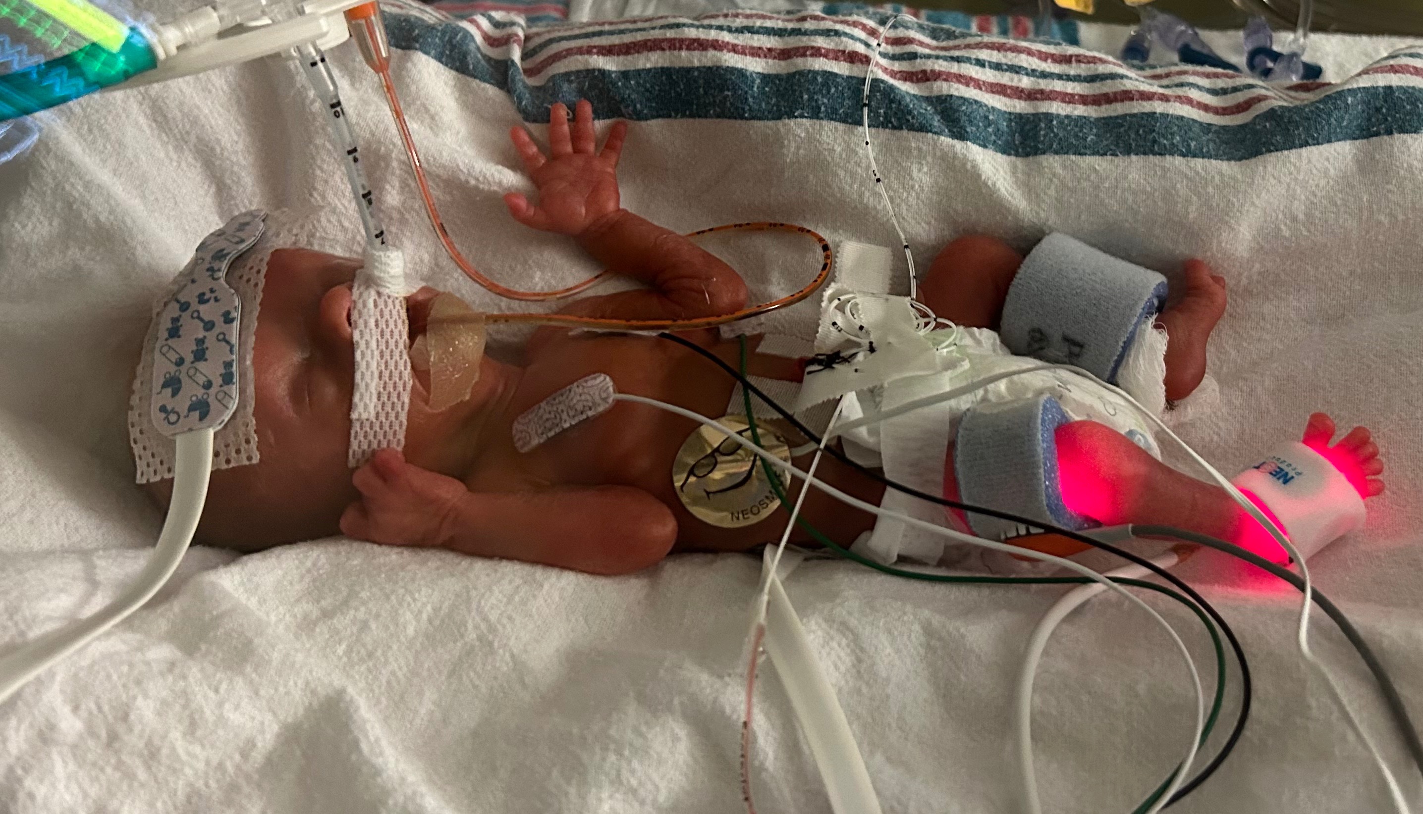 Support the Parker Family Through Hayes' Healing campaign photo, 4 of 5