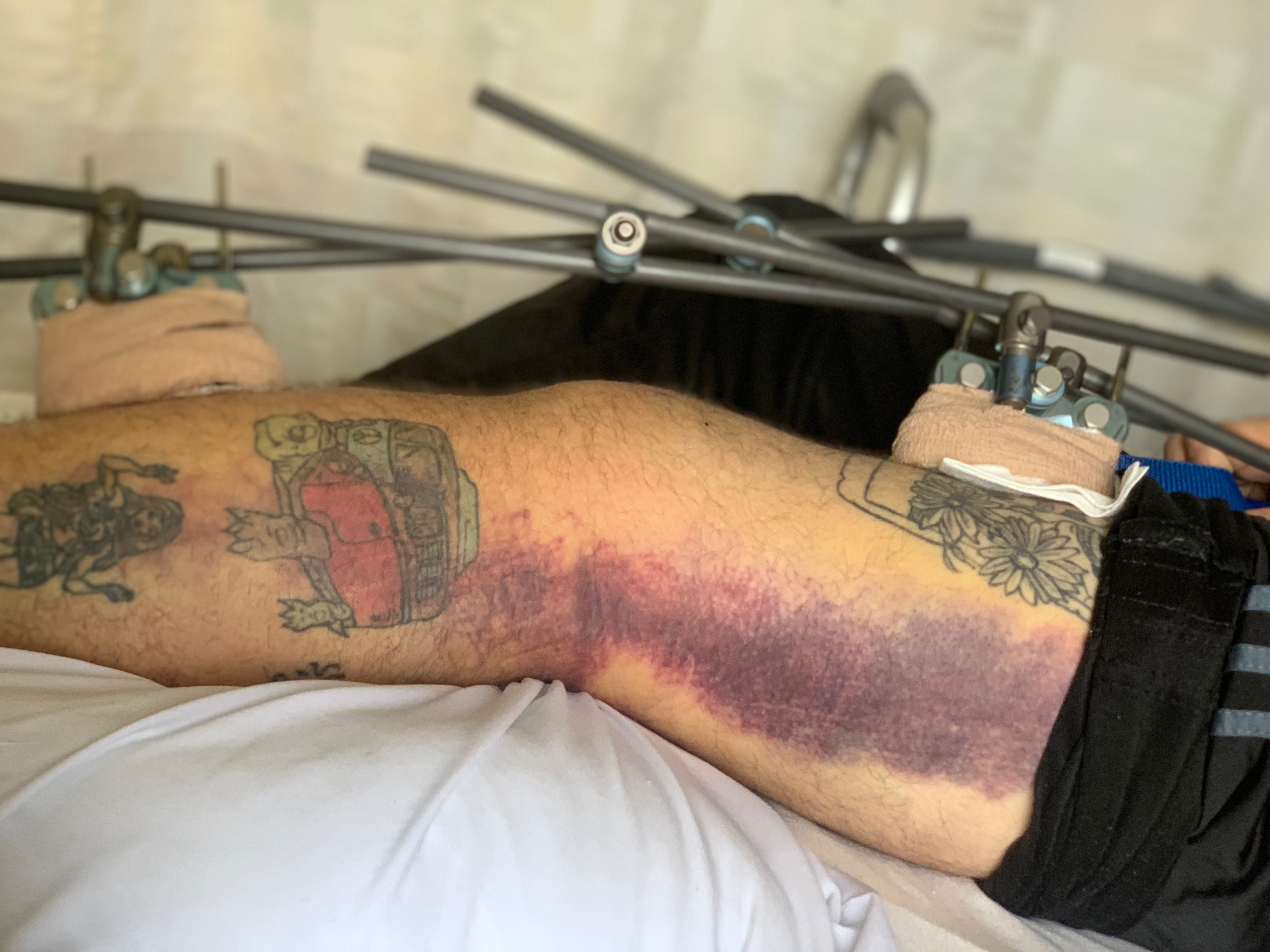 Support the Marcewicz Family after Motorcycle Accident campaign photo, 7 of 8