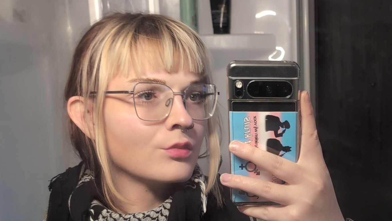 She's gender-affirming surgery photo