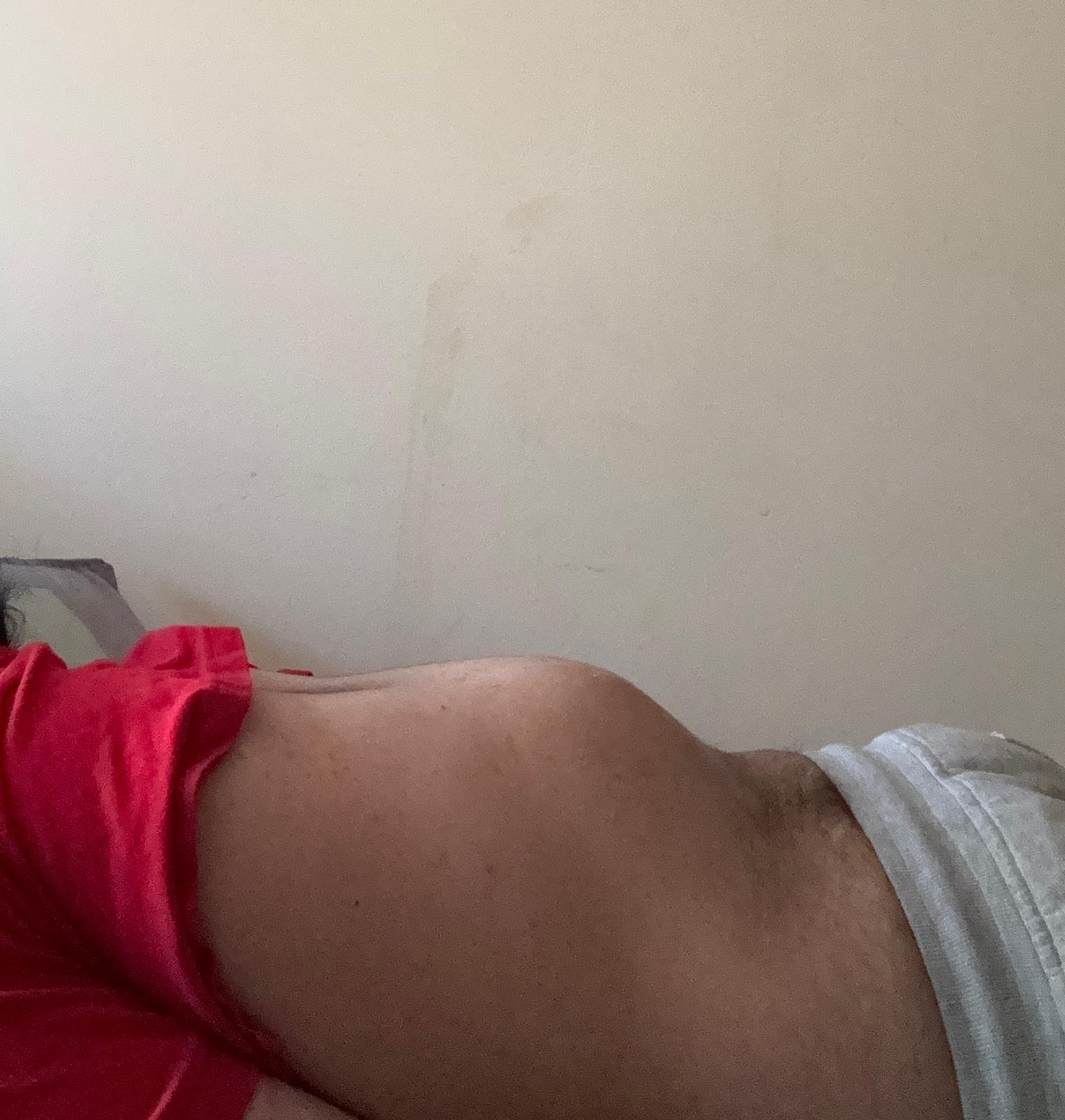 Help Me Get Life-Changing Back Surgery campaign photo, 7 of 8