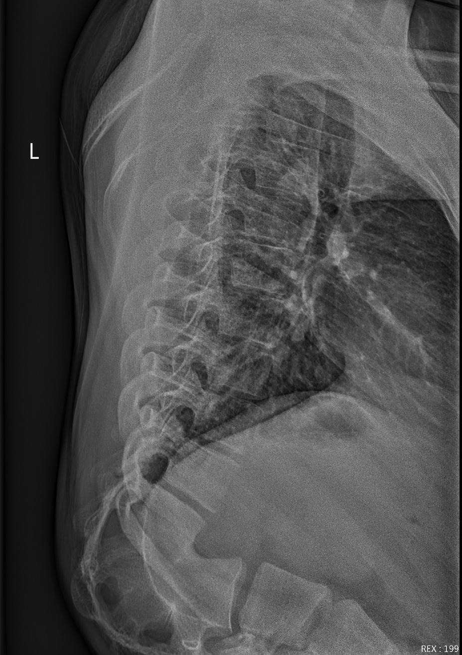 Help Me Get Life-Changing Back Surgery campaign photo, 4 of 8