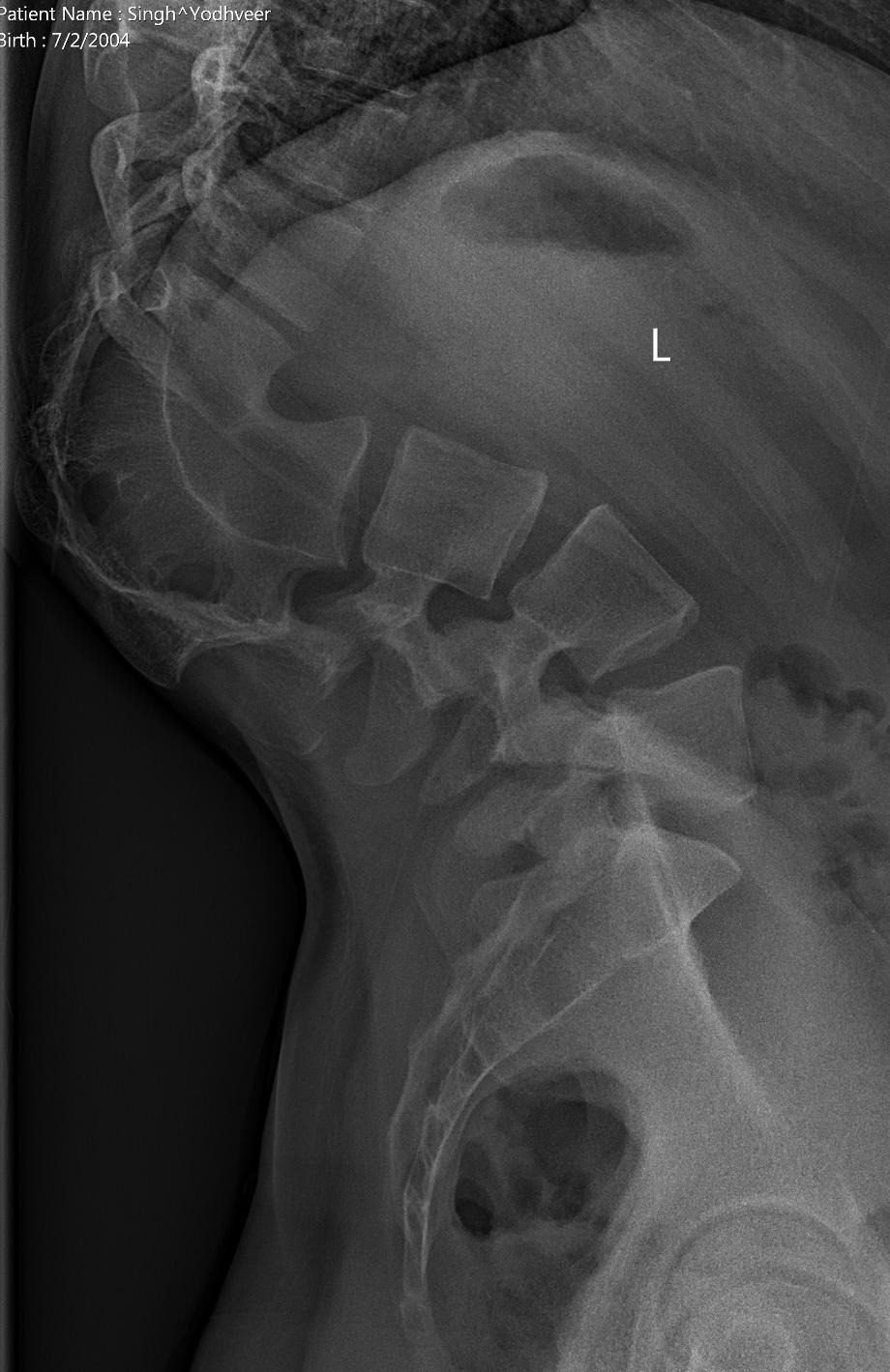 Help Me Get Life-Changing Back Surgery campaign photo, 5 of 8