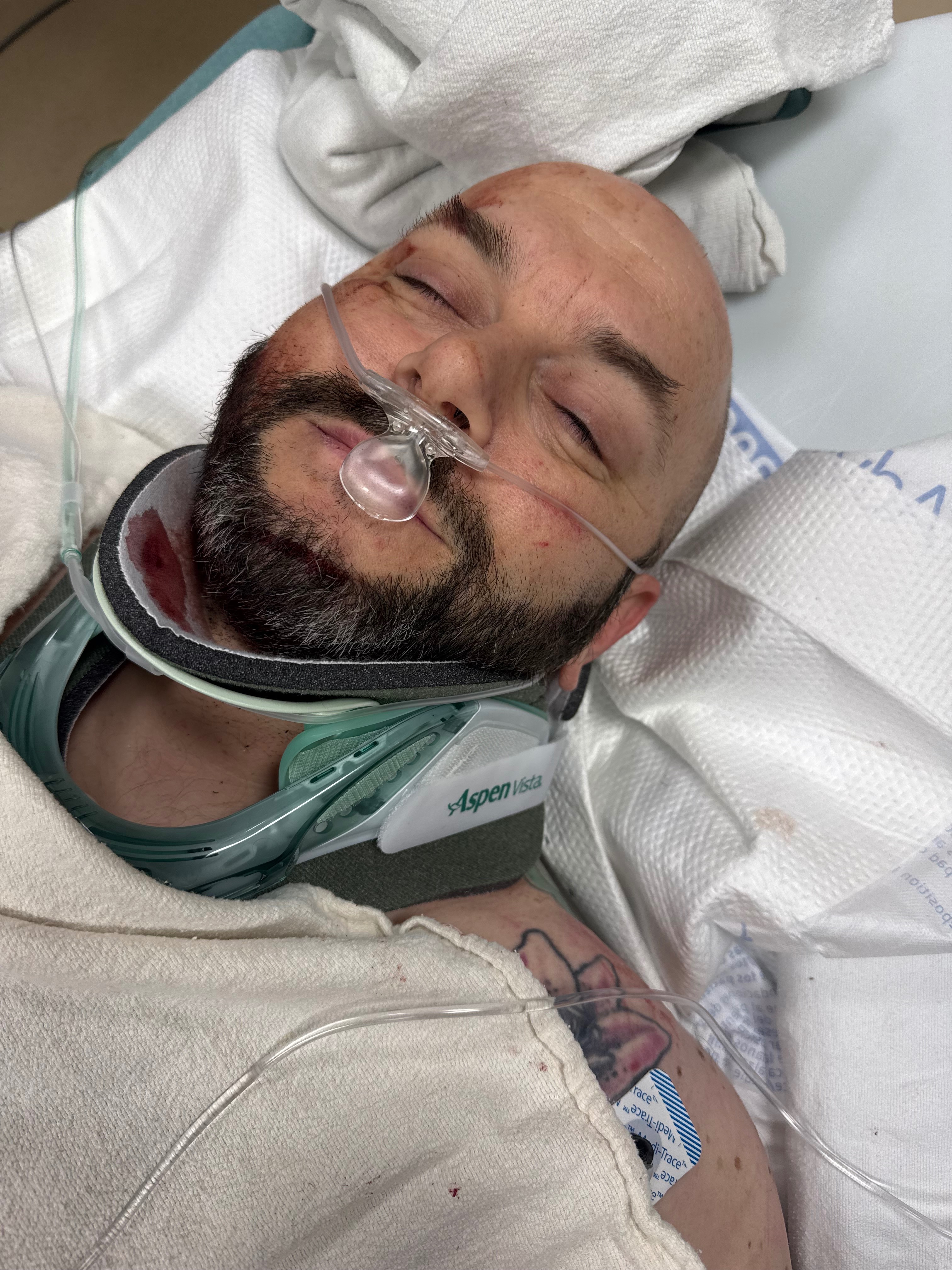 Help Matty through his recovery campaign photo, 2 of 8