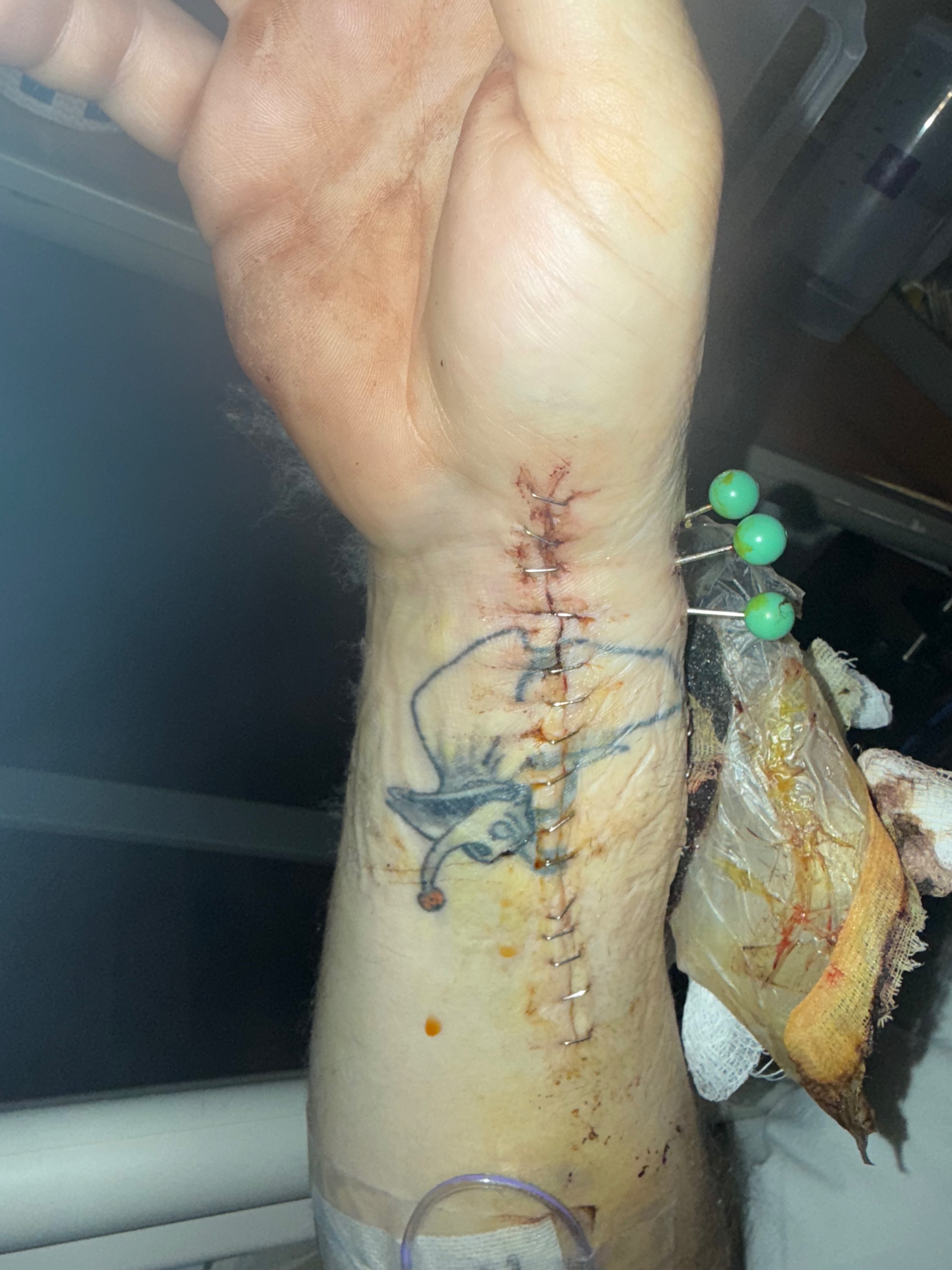 Help Matty through his recovery campaign photo, 4 of 8