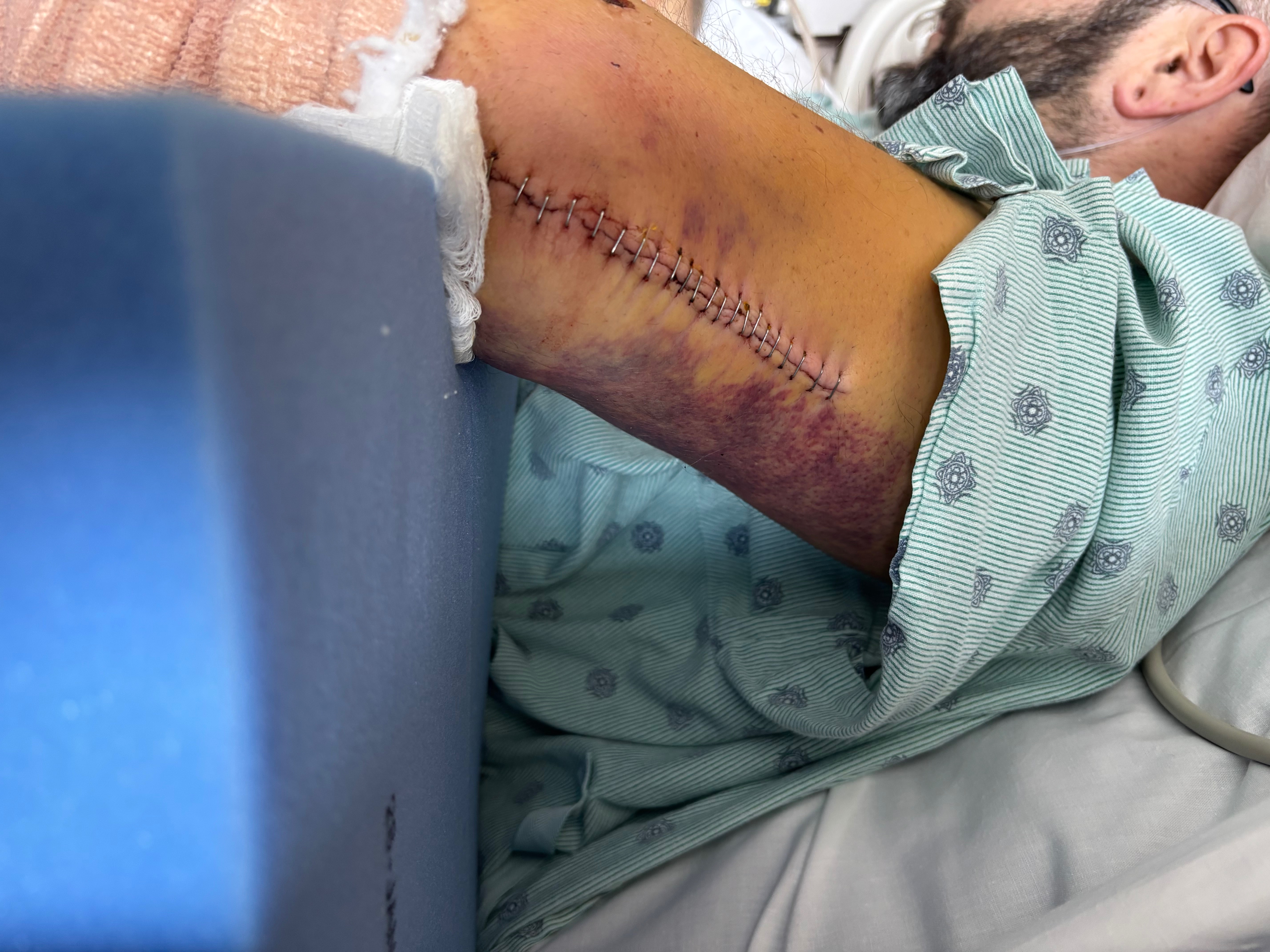 Help Matty through his recovery campaign photo, 5 of 8