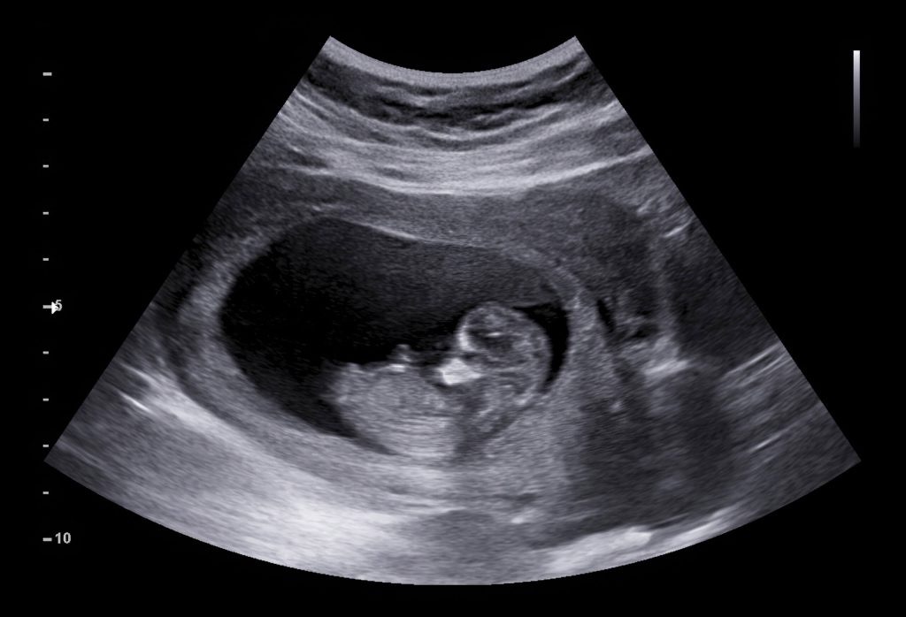 Support Momma “M” in Choosing Life! campaign photo, 2 of 4