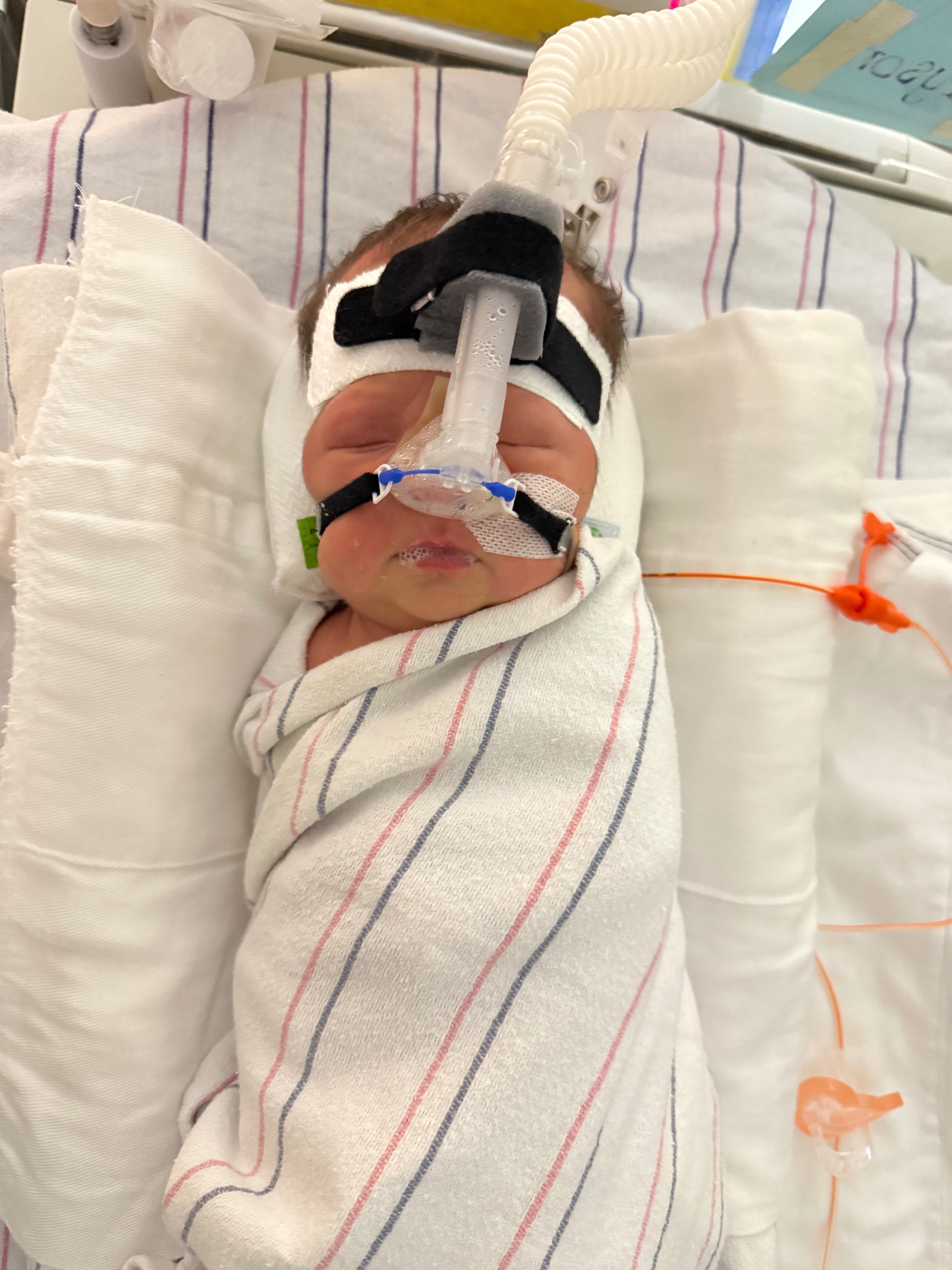Help support baby Grayson’s medical journey campaign photo, 6 of 7