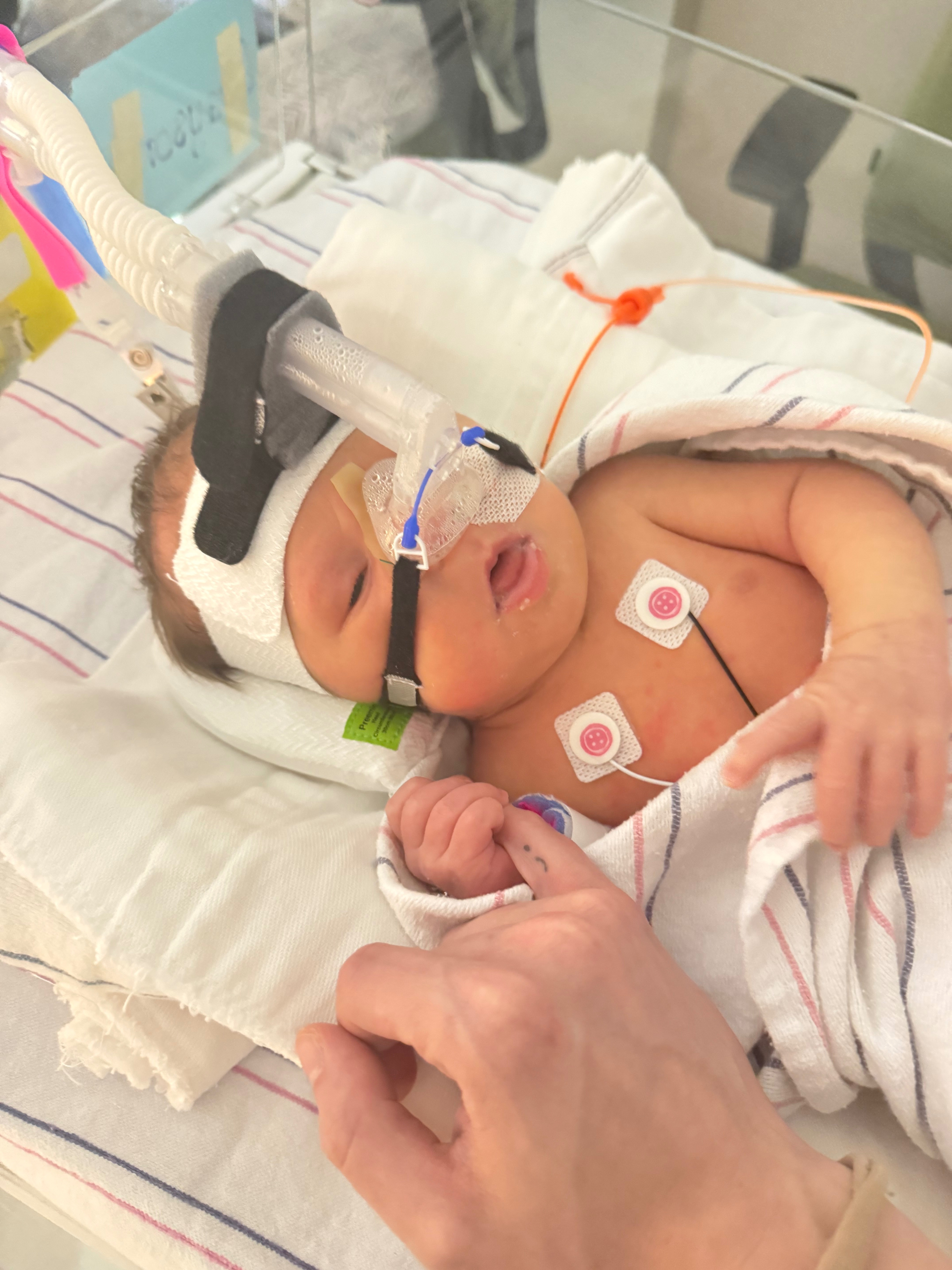 Help support baby Grayson’s medical journey campaign photo, 2 of 7
