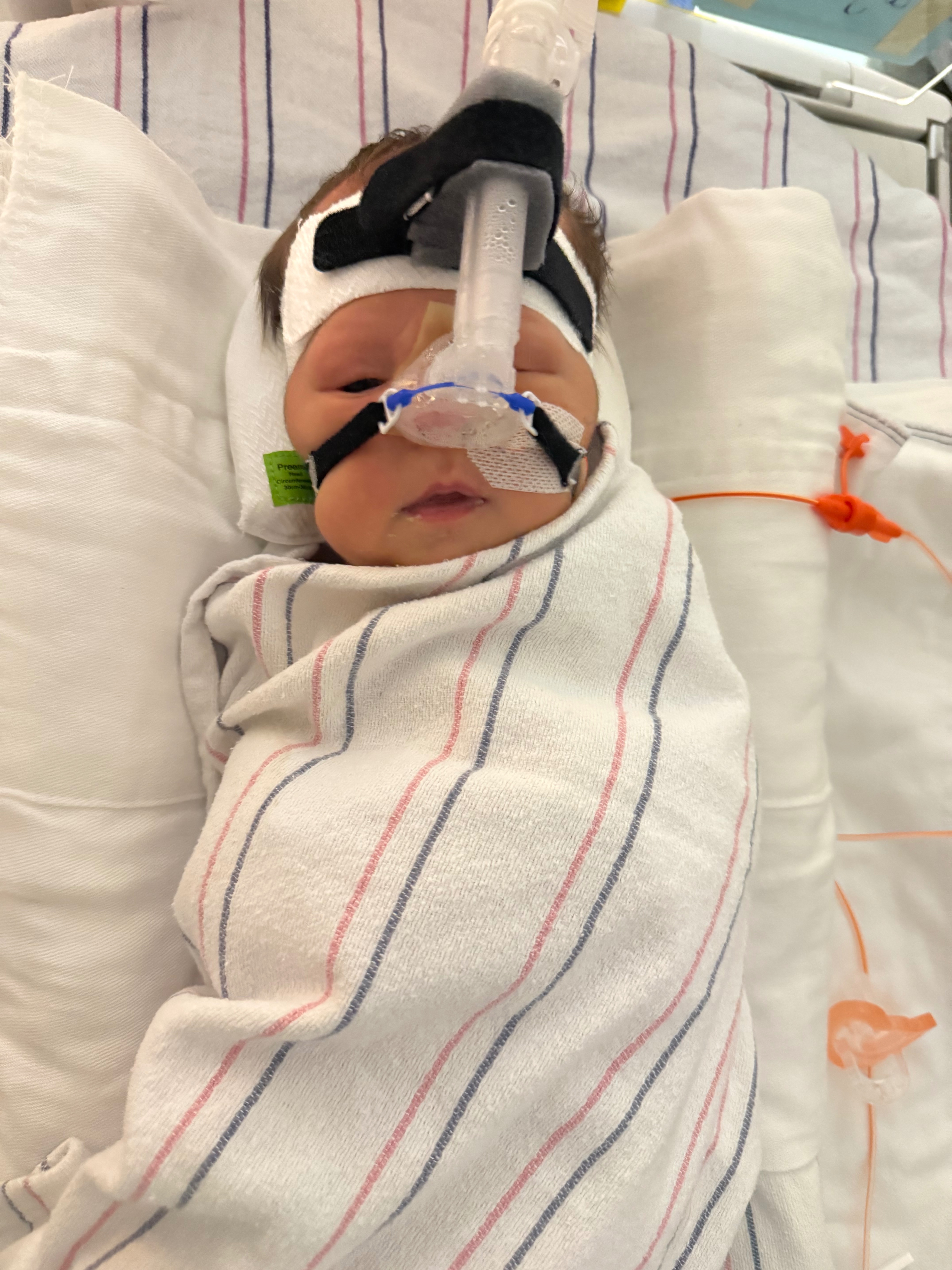 Help support baby Grayson’s medical journey campaign photo, 4 of 7