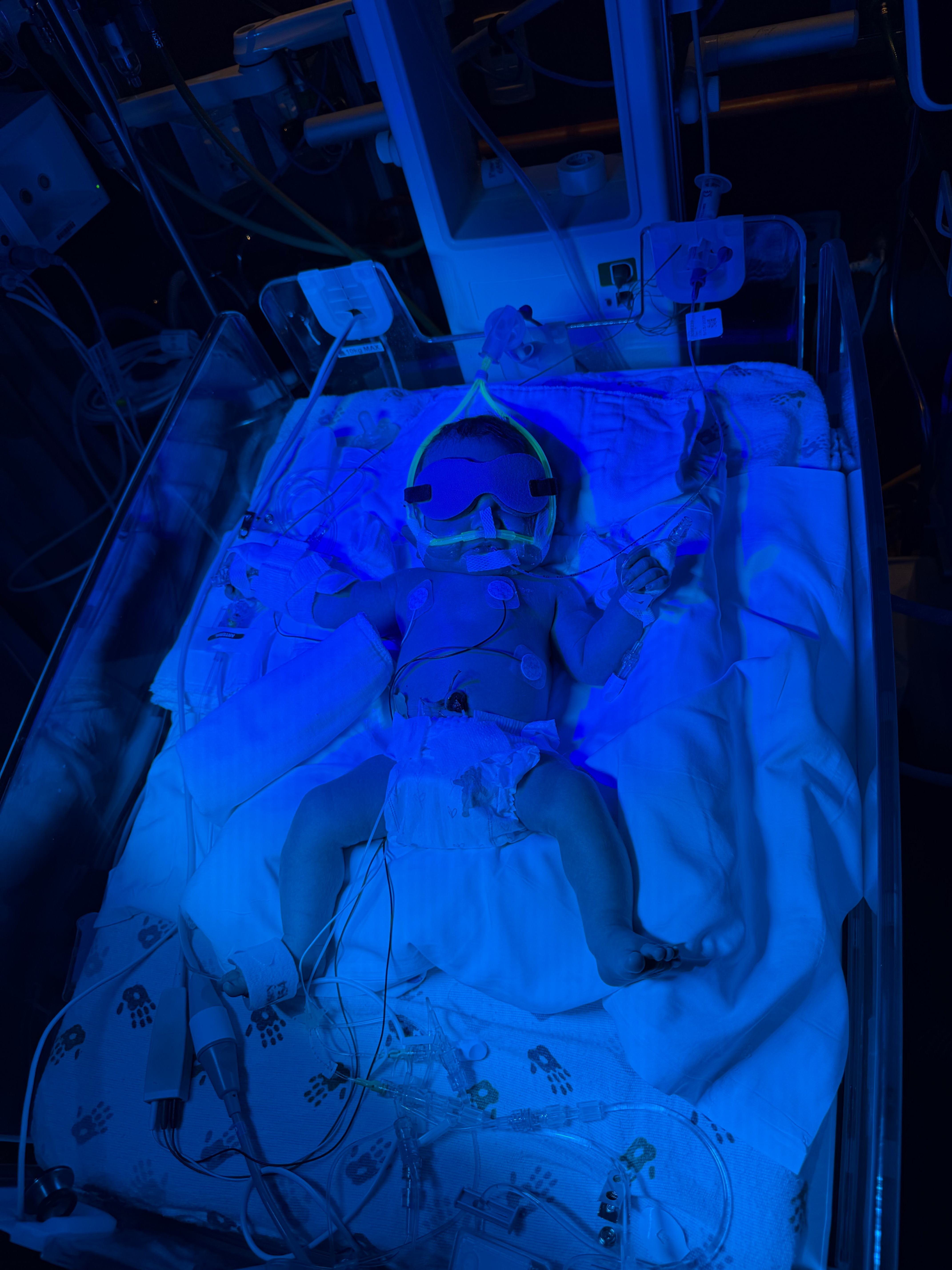 Rally for Baby Raasch’s Recovery campaign photo, 4 of 8