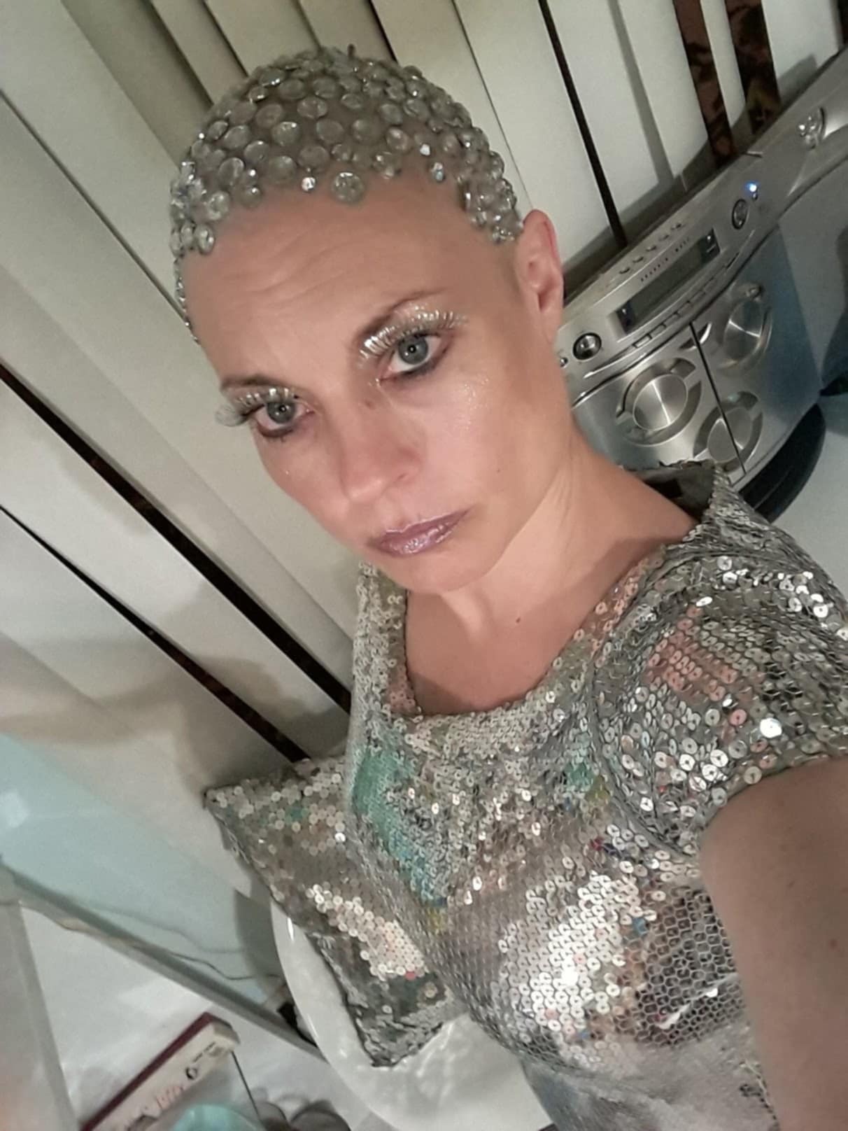 Lisa is Fighting Cancer Again: Proton Therapy Support needed campaign photo, 5 of 8