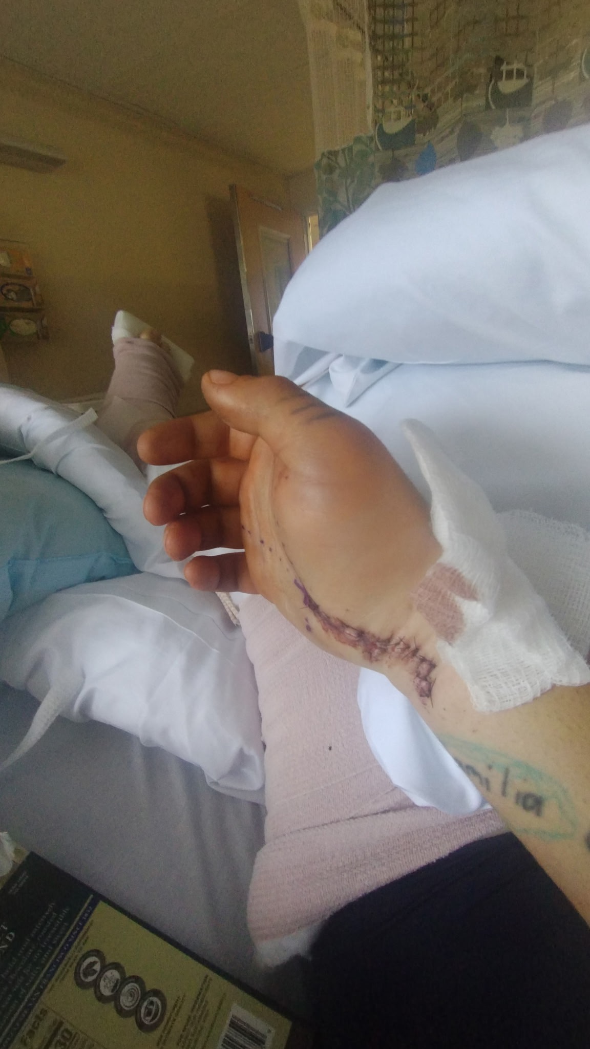Help Josh Heal: Hit by Uninsured Driver campaign photo, 4 of 8