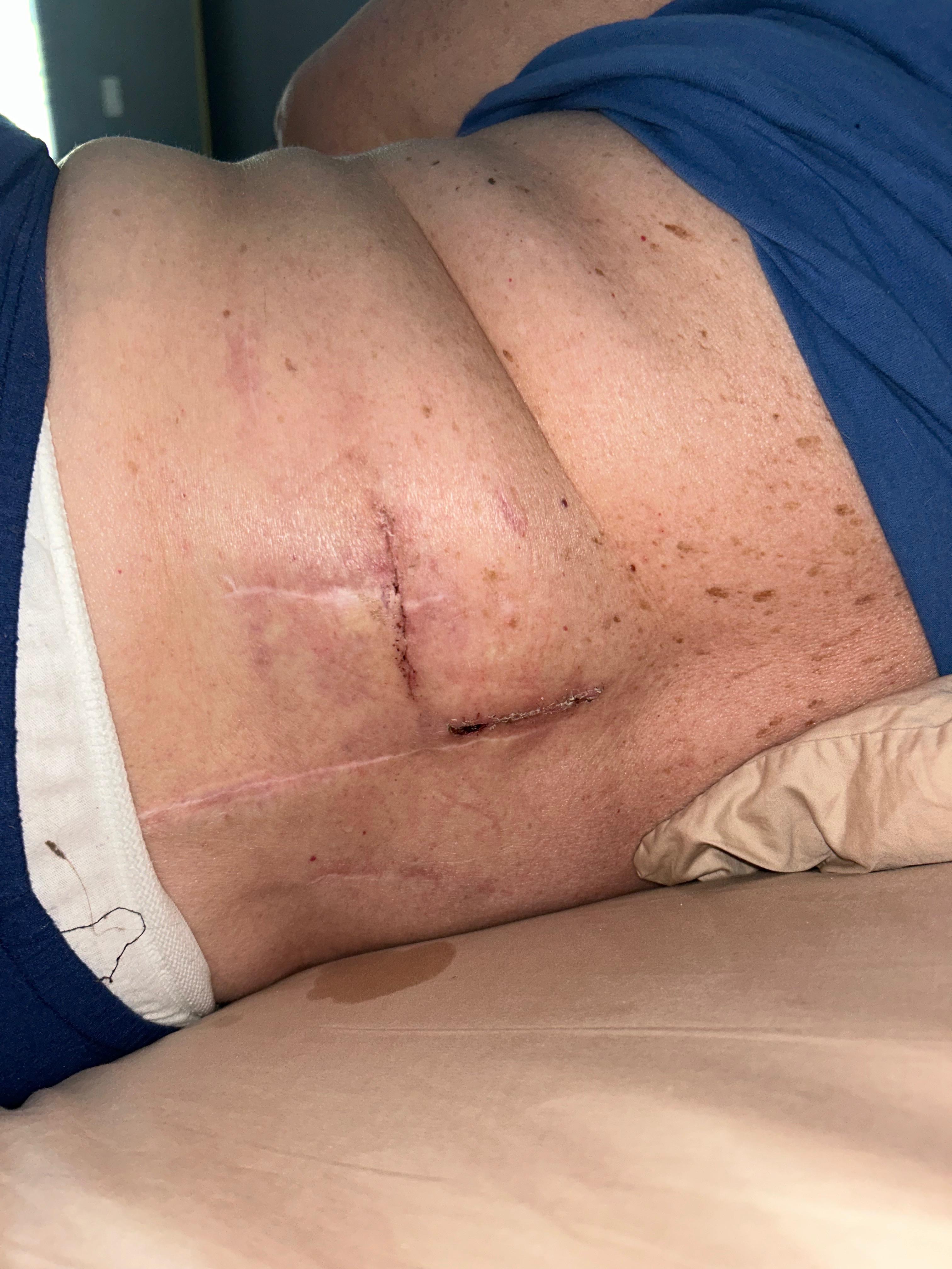 Support Nubia's Recovery After 11 Surgeries campaign photo, 6 of 7