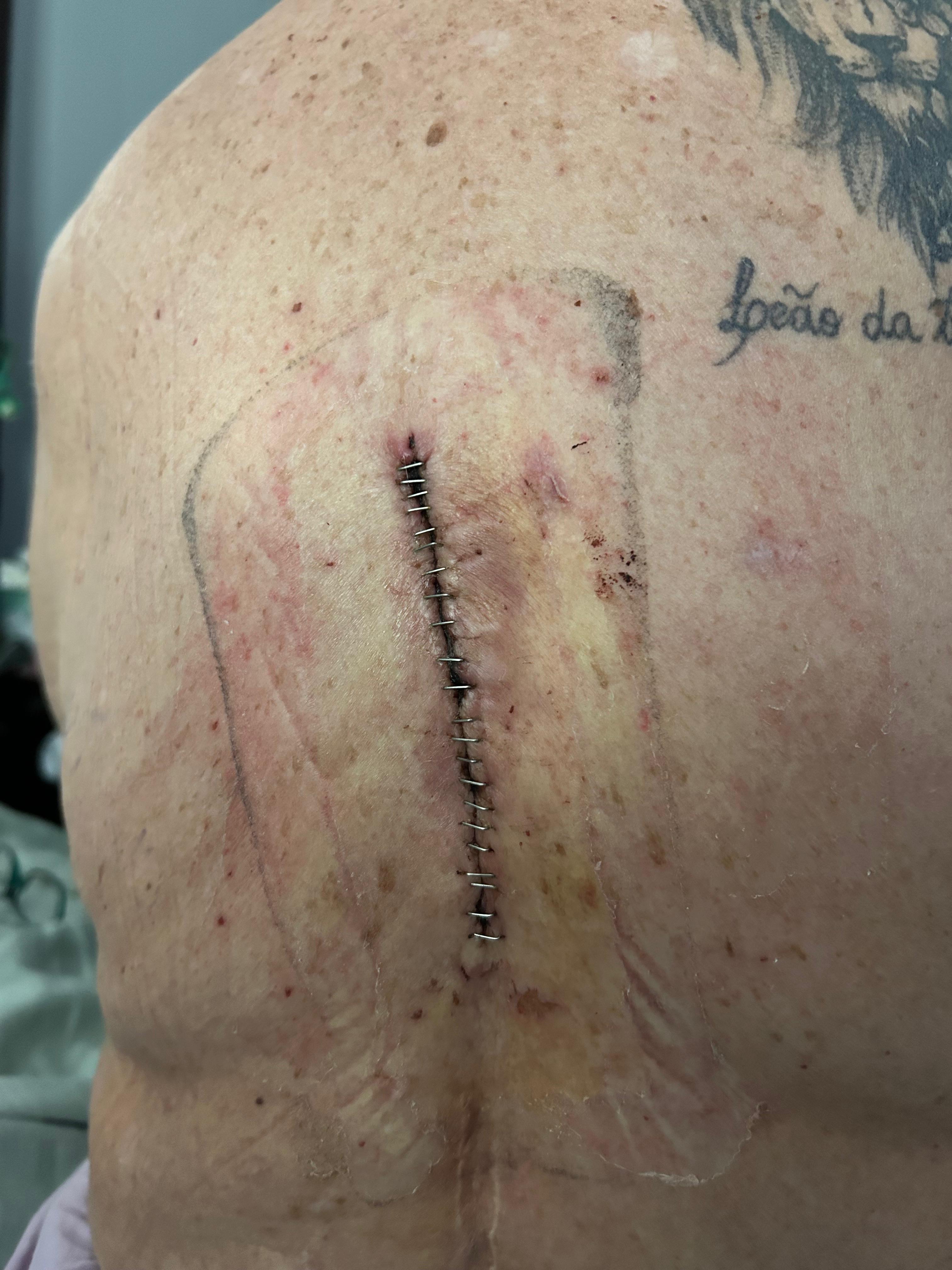 Support Nubia's Recovery After 11 Surgeries campaign photo, 4 of 7