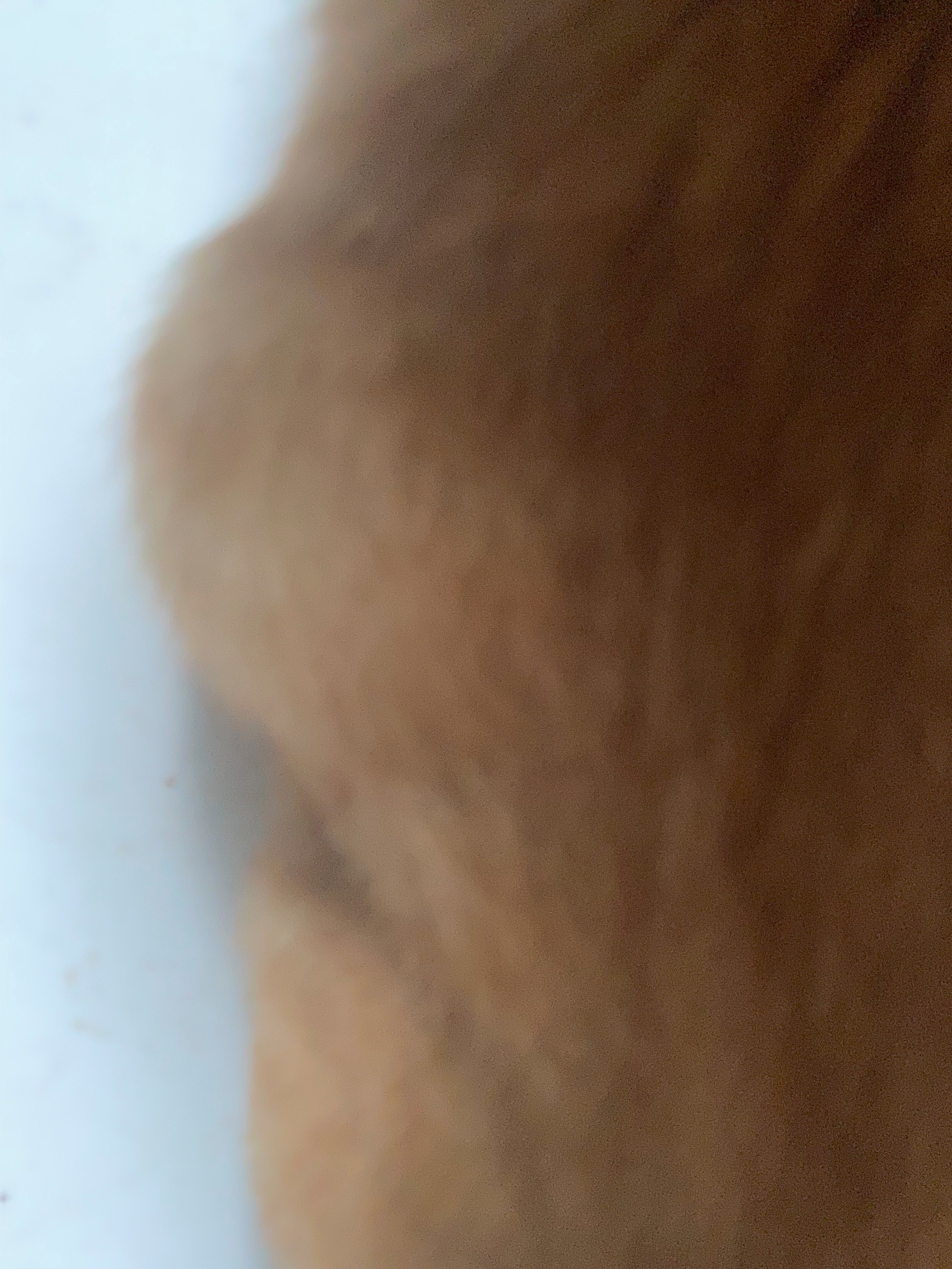 Sammie Girl Needs Emergency Surgery to Save Her Life campaign photo, 6 of 8