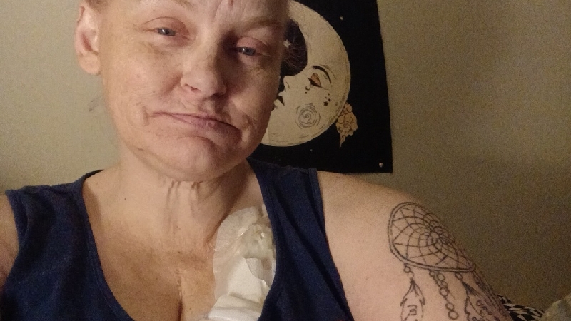 Help Mom Fight very aggressive stage 4 small bowl cancer photo