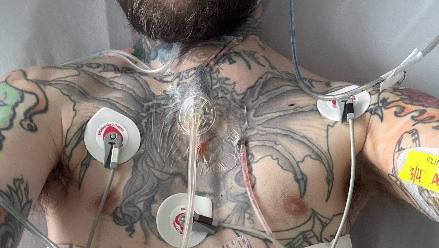 Wayne's Urgent Need: Surgery and Support photo