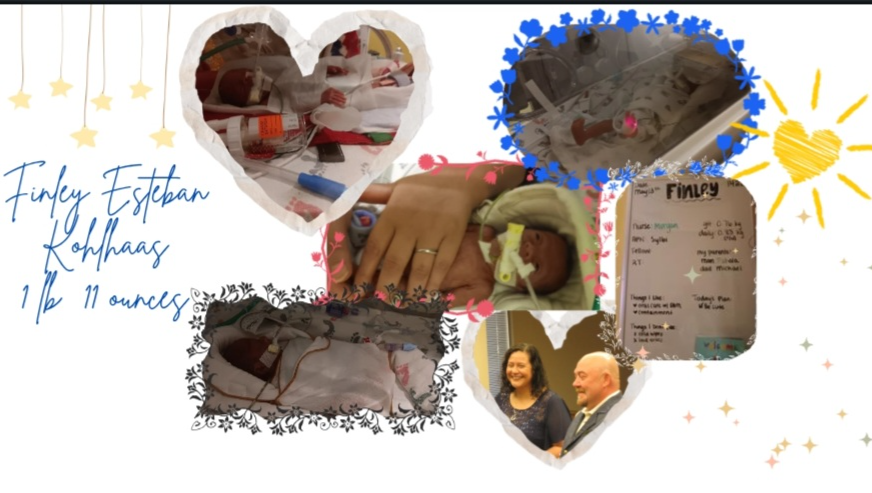 Support Baby Finley Kohlhaas photo
