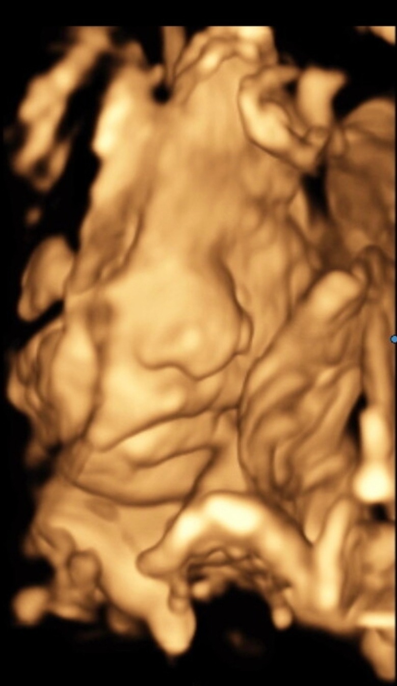 Help Us During A High Risk Pregnancy and NICU Journey campaign photo, 5 of 8