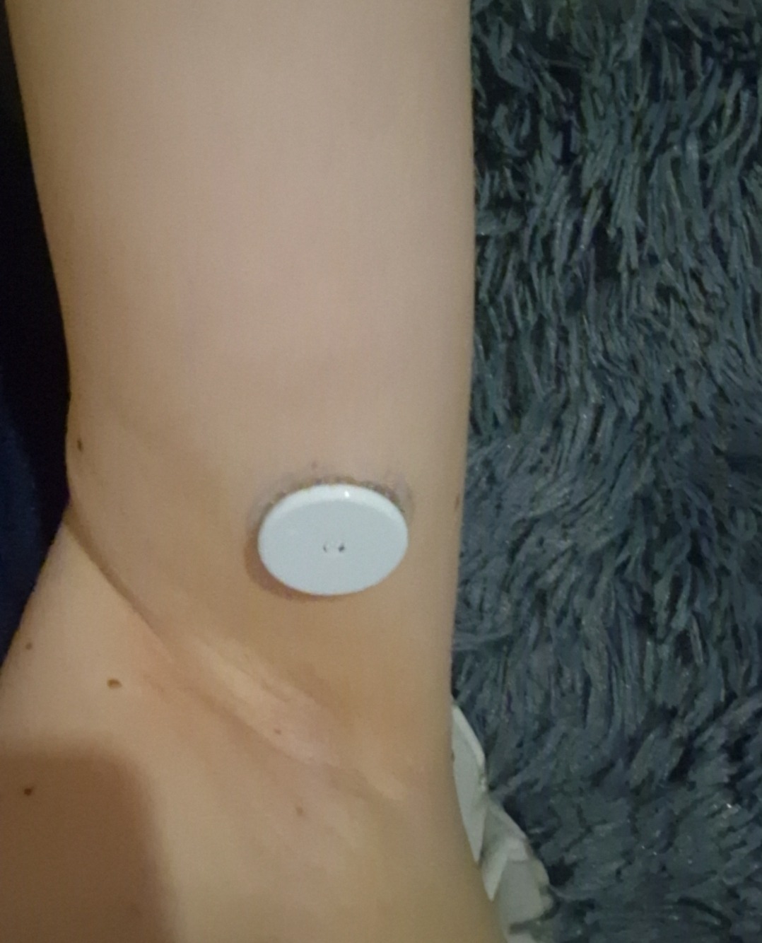 Insulin pump for diabetic type 1 campaign photo, 7 of 7