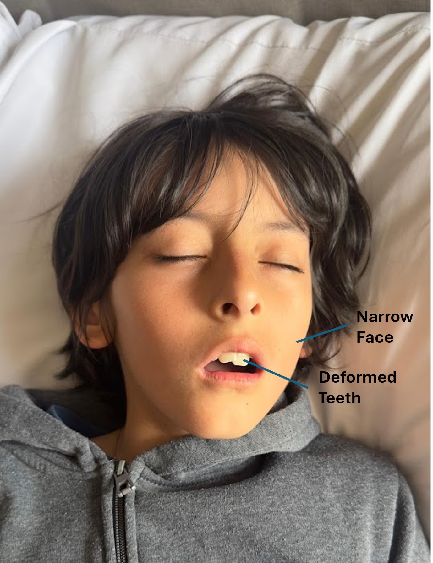Urgent Treatment Needed for Simon's Health campaign photo, 5 of 8