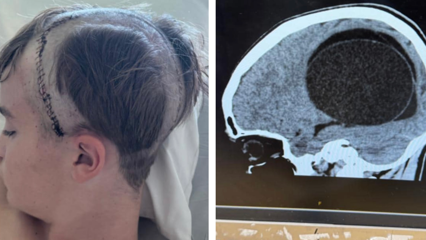 Help Support Theo and His Family on His Journey to Recovery photo