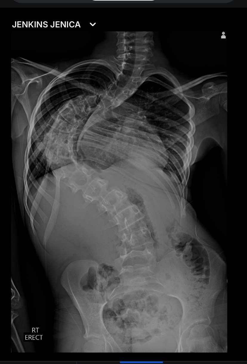 Help with traveling expenses for Jenica’s surgery campaign photo, 4 of 8