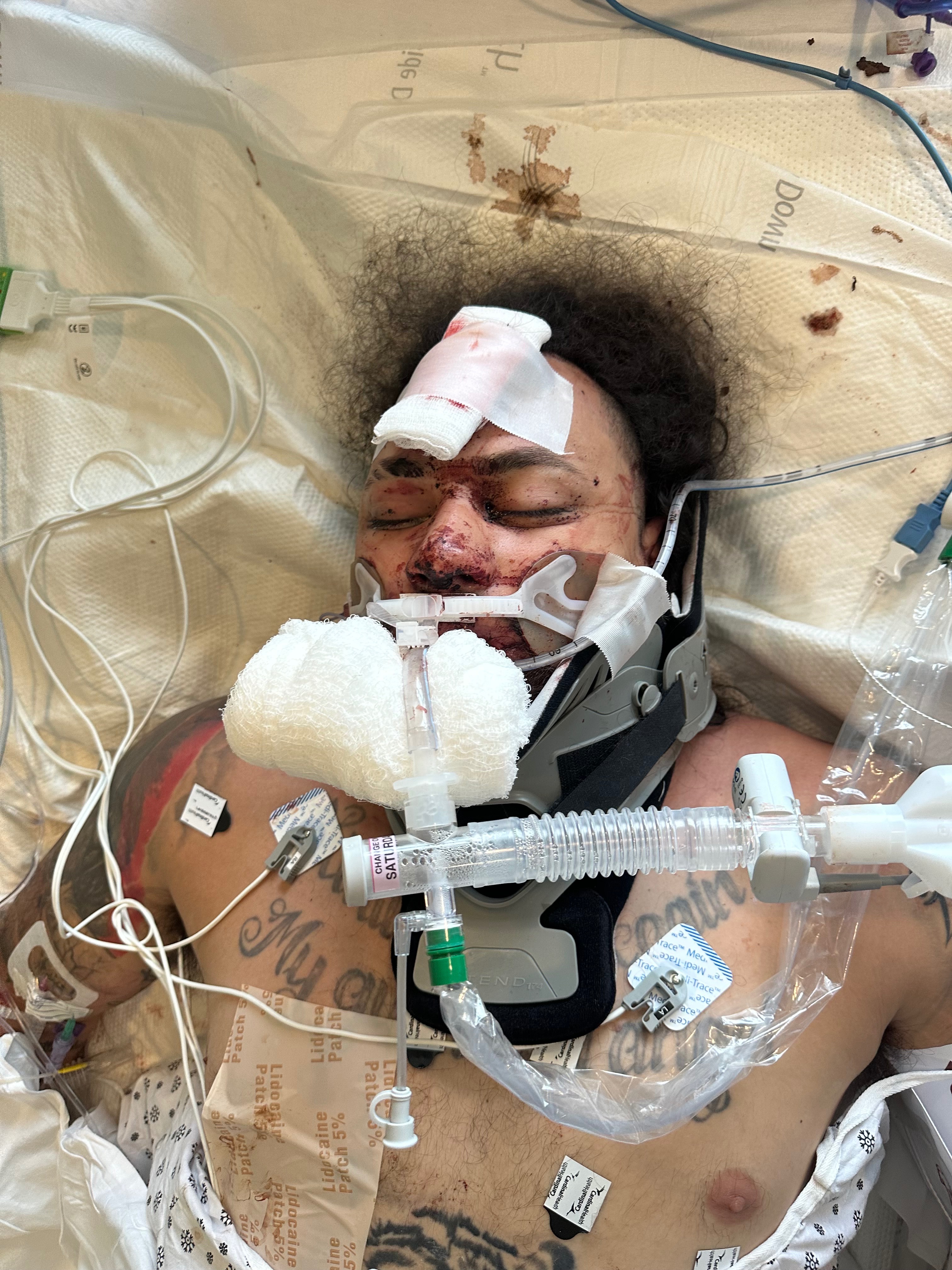 Help Me Fight for My Independence After a Spinal Cord Injury campaign photo, 4 of 6