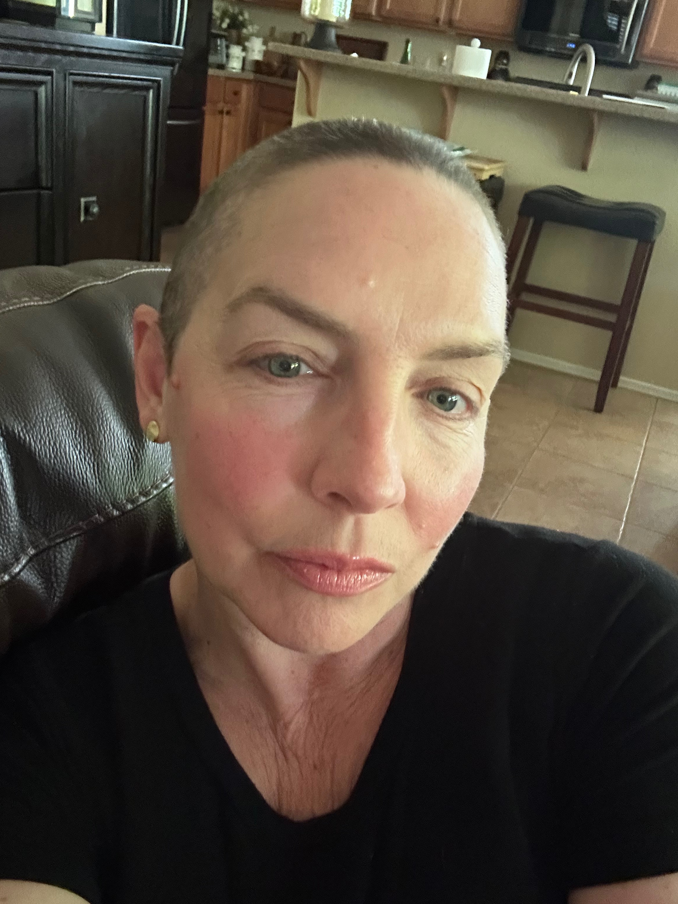 Help Kim rebuild after stage 4 breast cancer. campaign photo, 4 of 5