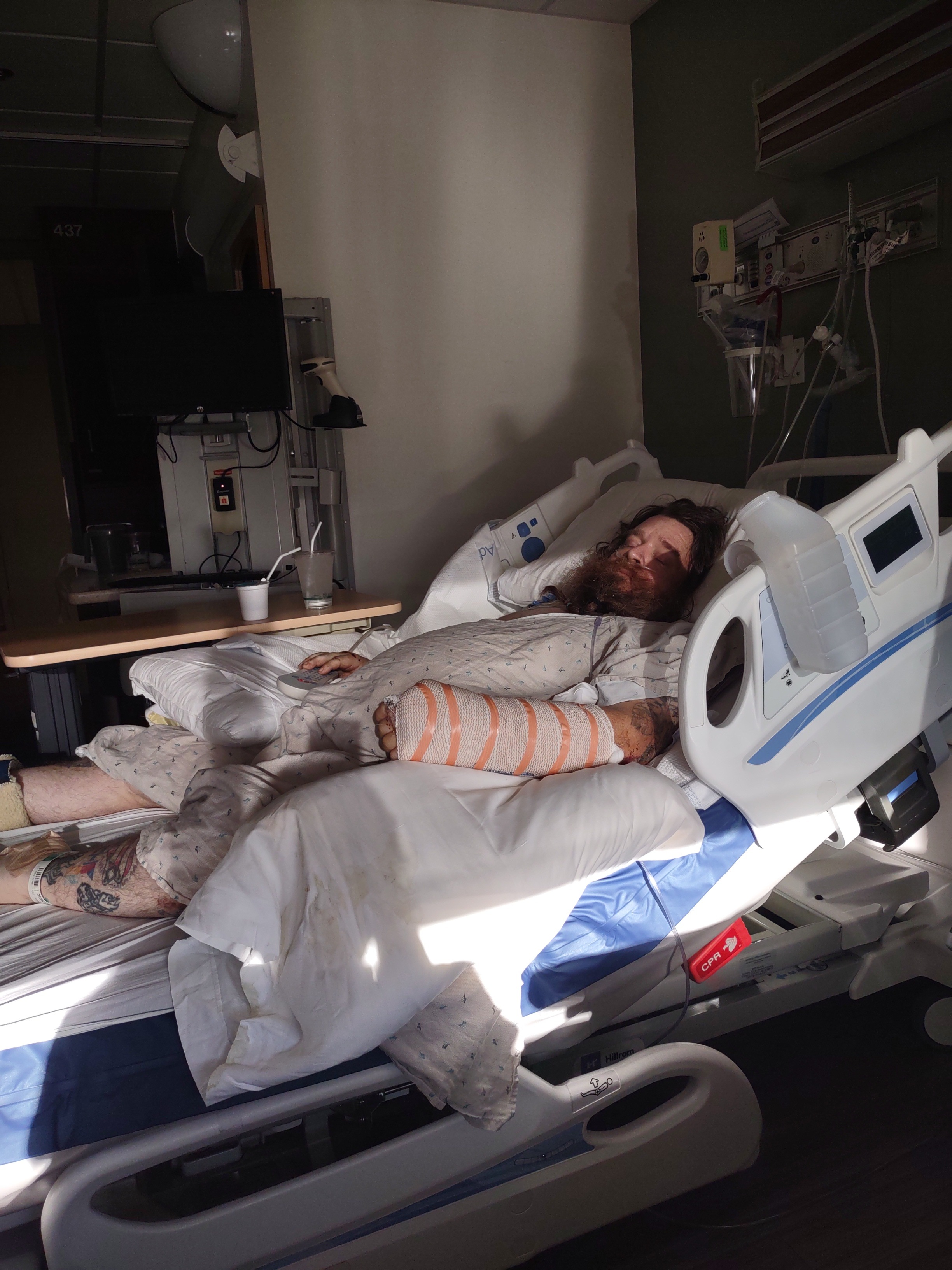 Support Yosef's Recovery After Crash campaign photo, 2 of 4