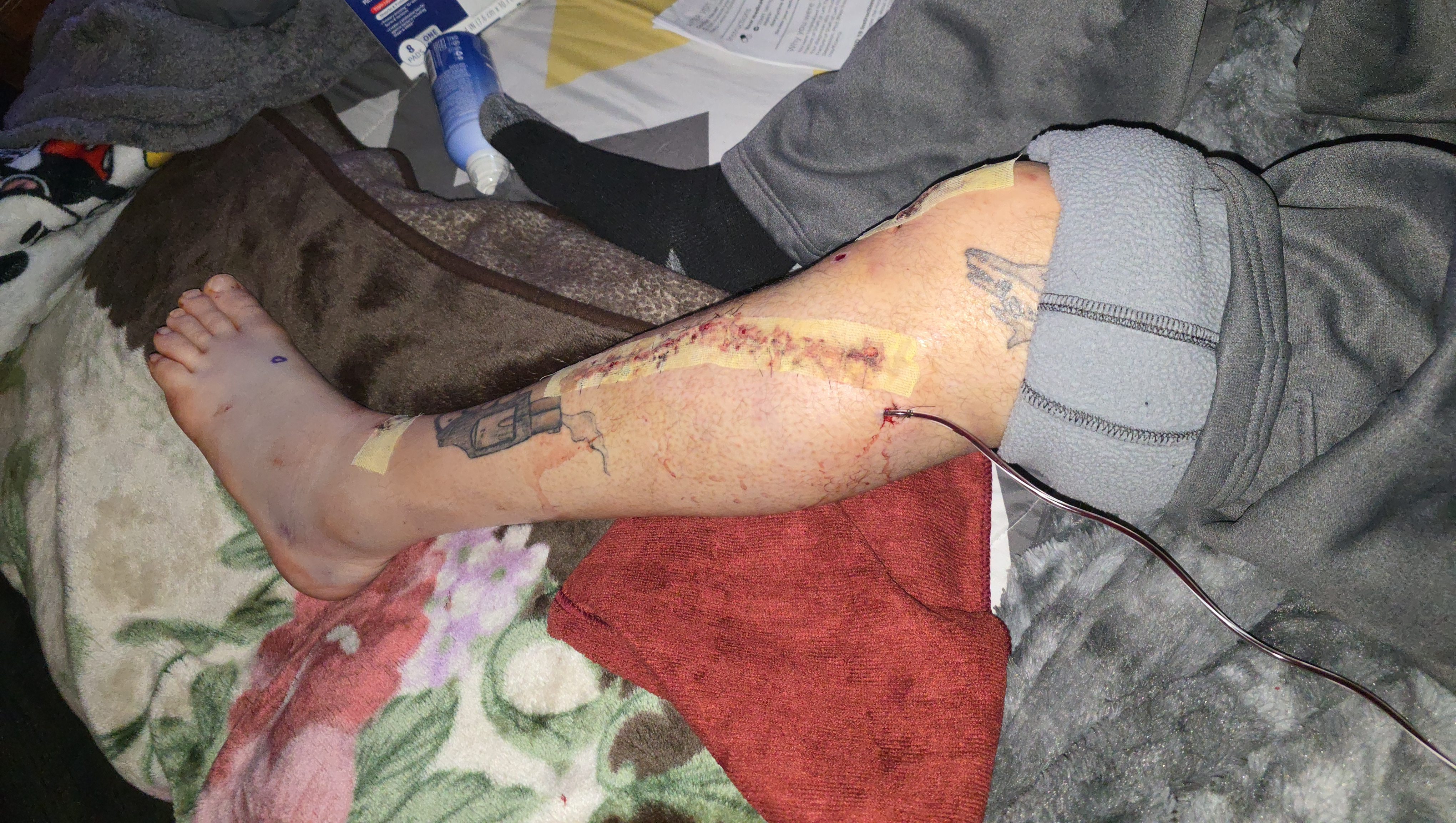 Motorcycle Crash: can't work, no food photo
