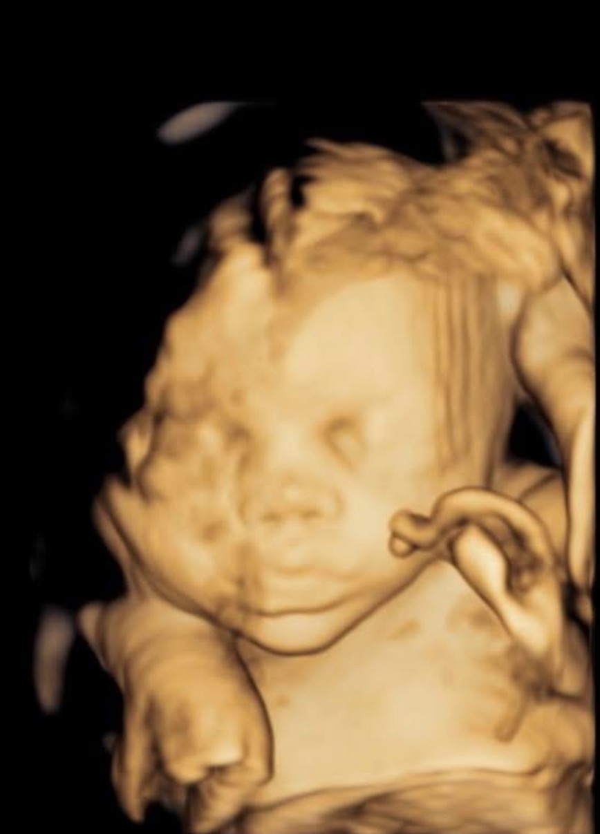 HLHS Warrior: Baby Brooks' Fund campaign photo, 4 of 6