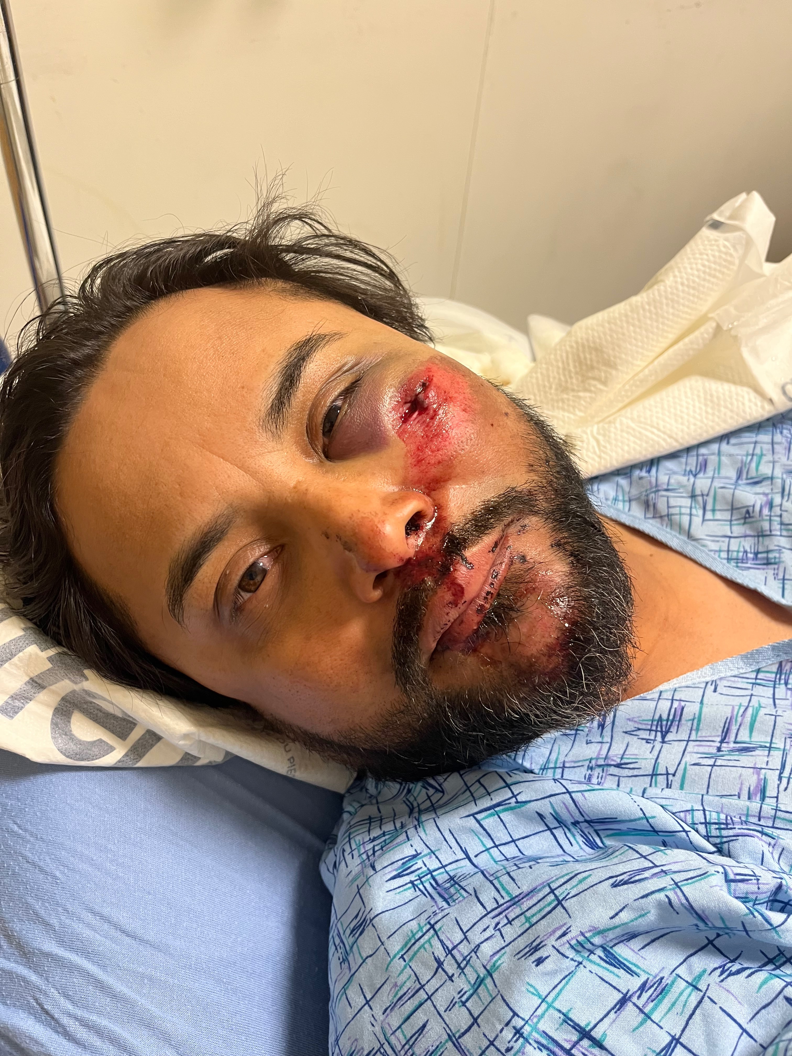 Support Isaac's Medical Bills After Accident campaign photo, 7 of 8