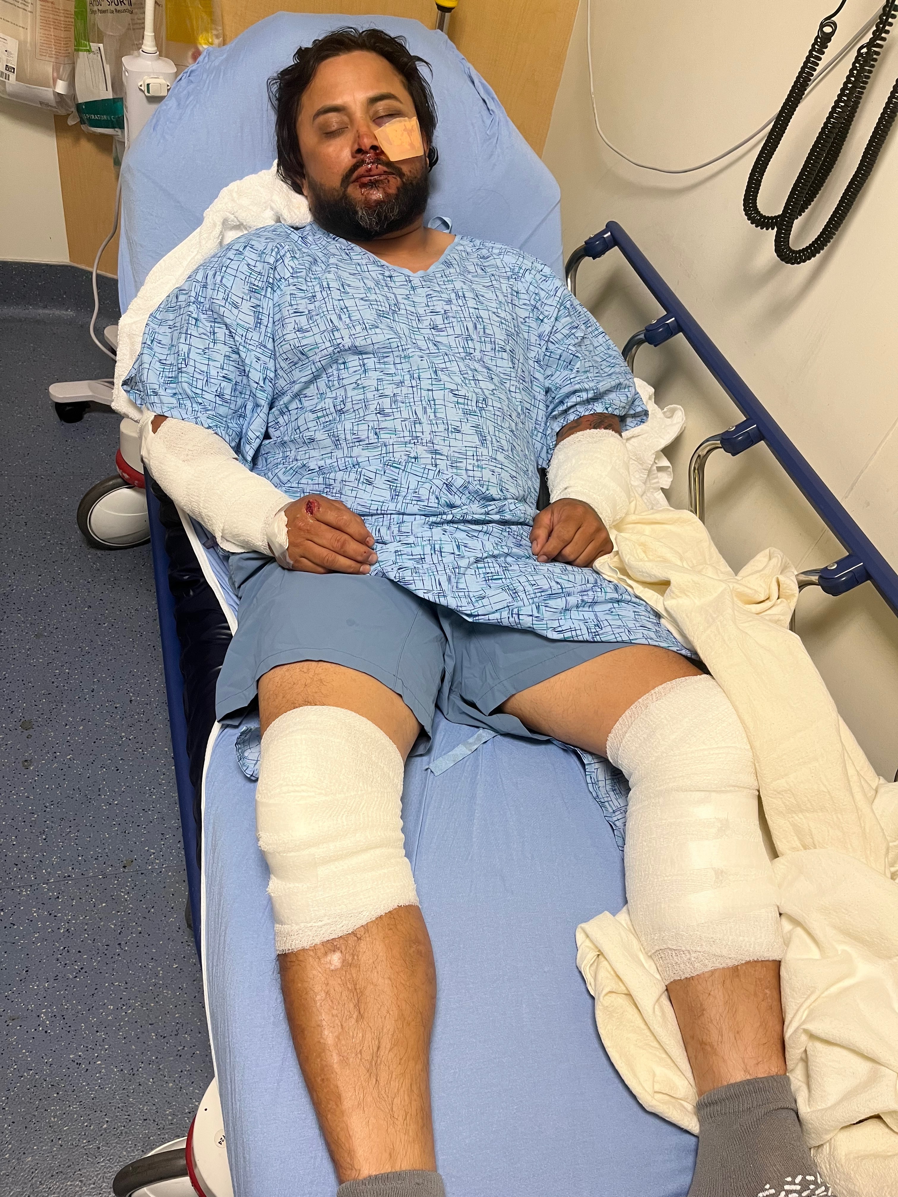 Support Isaac's Medical Bills After Accident campaign photo, 2 of 8