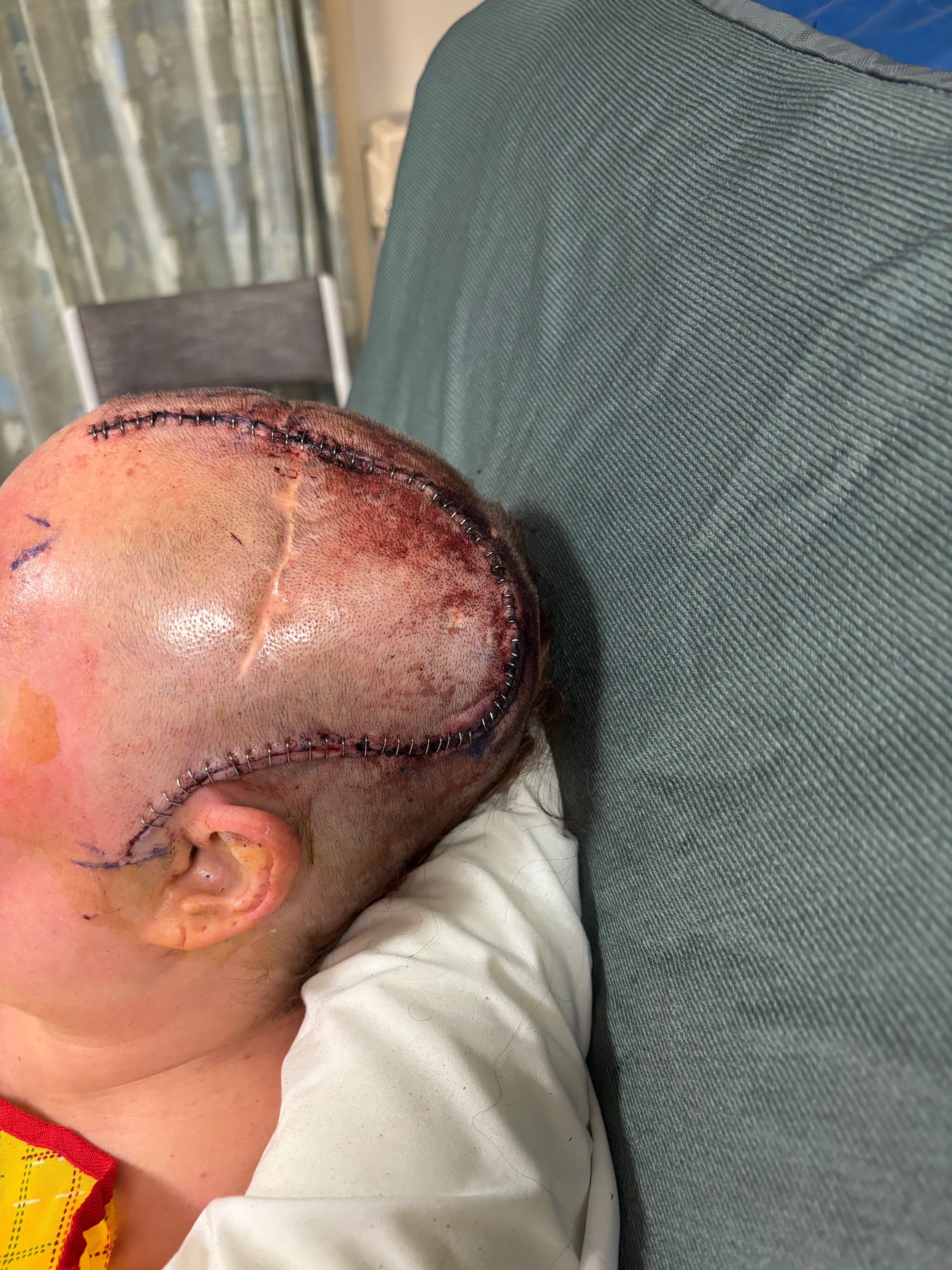 Help My Daughter After Her ATV Accident campaign photo, 5 of 8