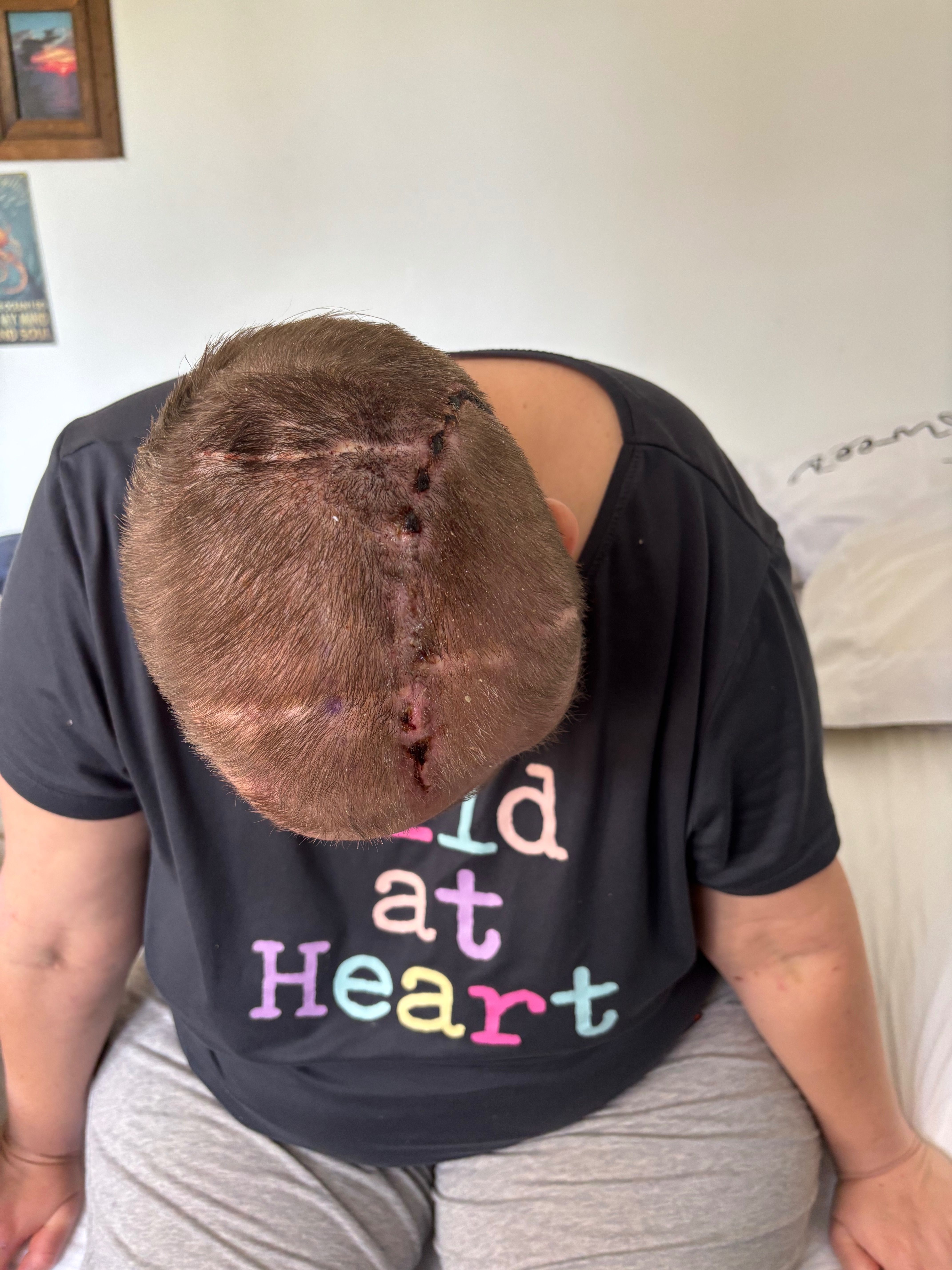 Help My Daughter After Her ATV Accident campaign photo, 6 of 8