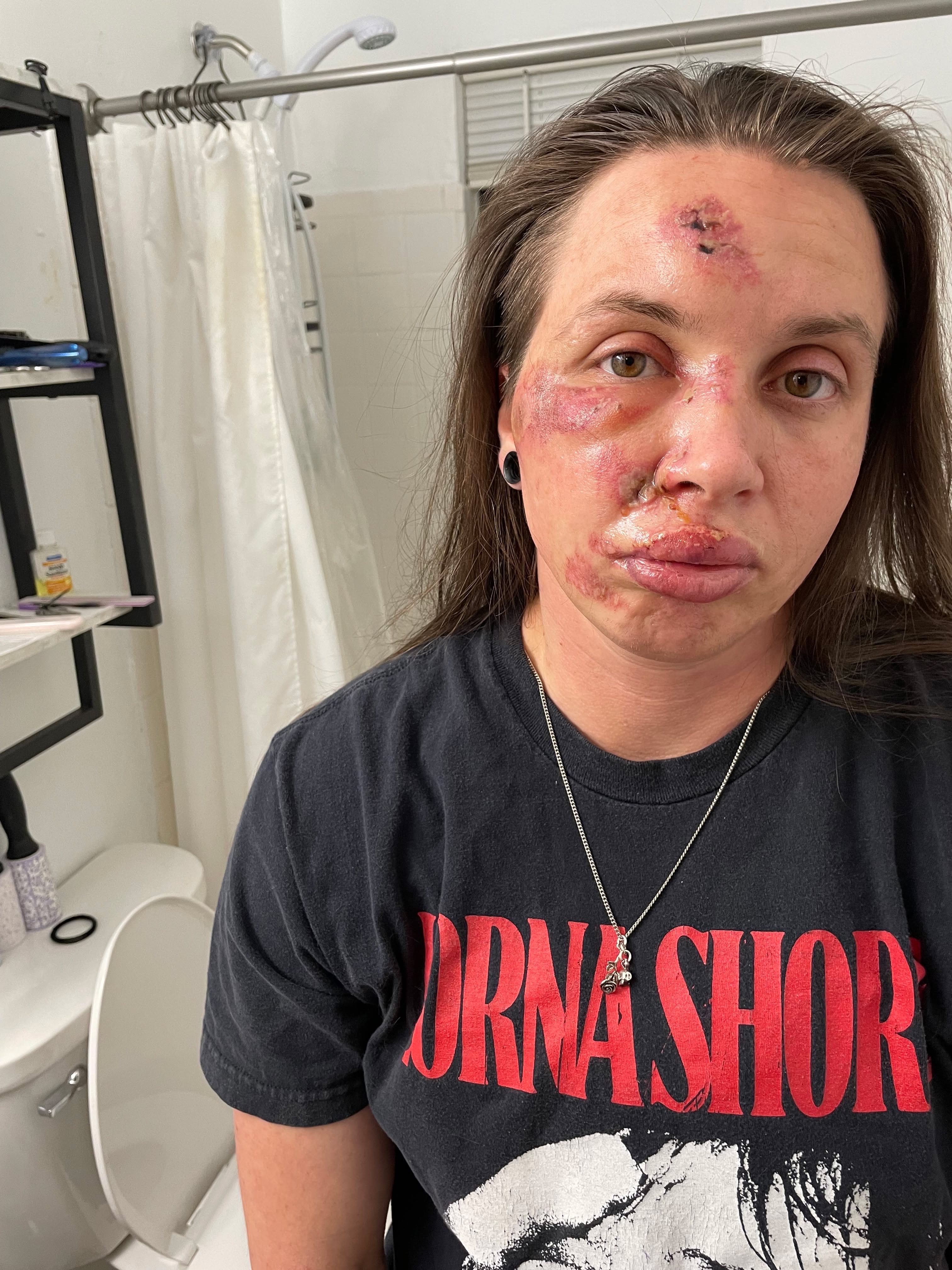 Recovering from being brutalized by police campaign photo, 6 of 8