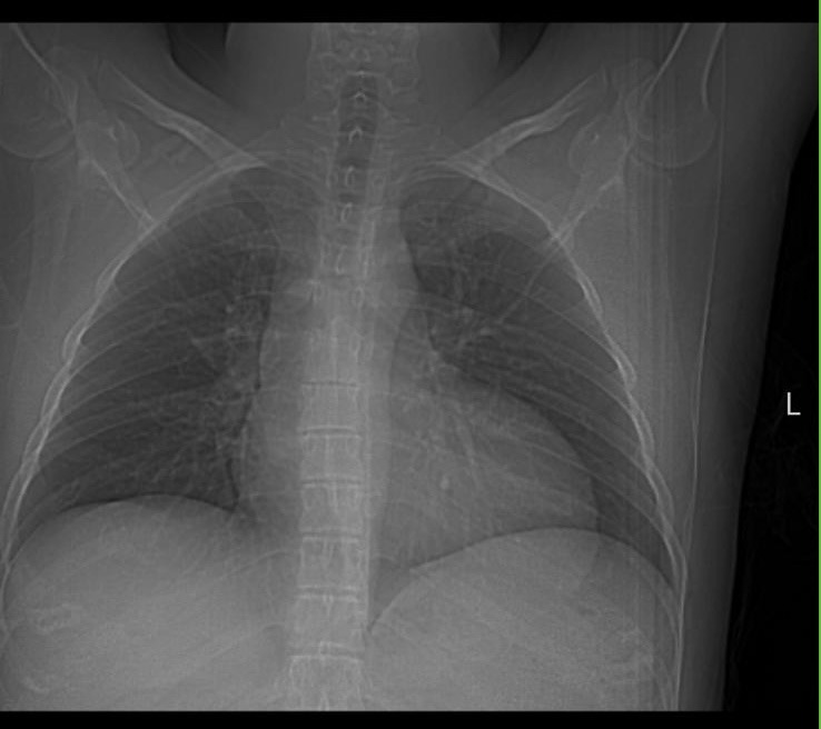 Help Ricardo Through His Open-Heart Surgery campaign photo, 7 of 8