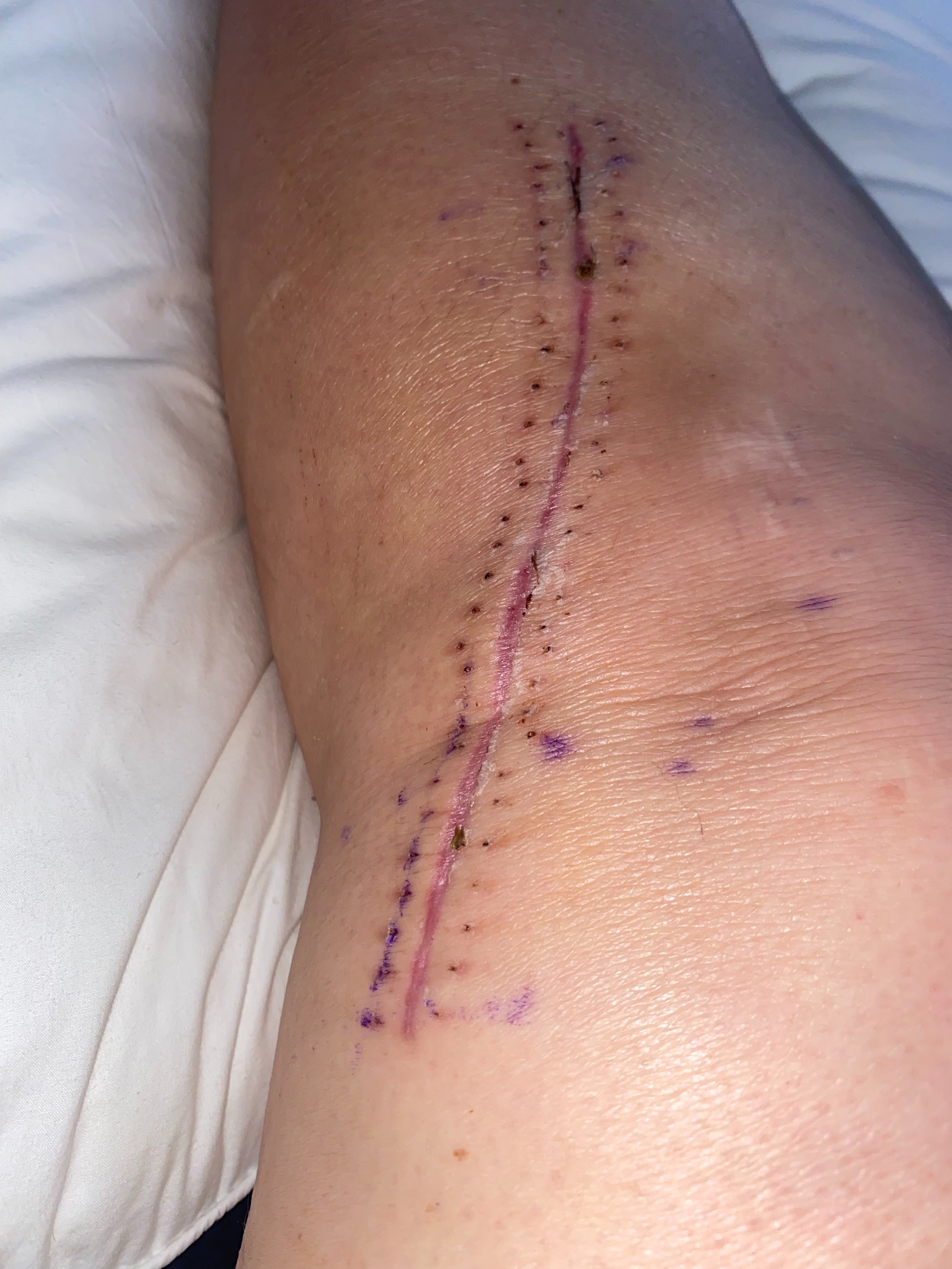Assist Missy in Recovery Costs campaign photo, 4 of 6