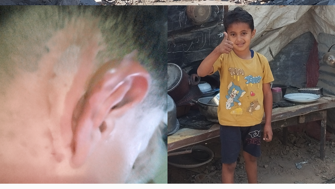 Moein's Family Needs Your Help to Recover photo