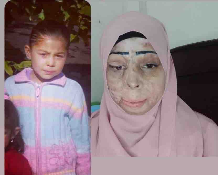 Let’s Help Rahma campaign photo, 2 of 7