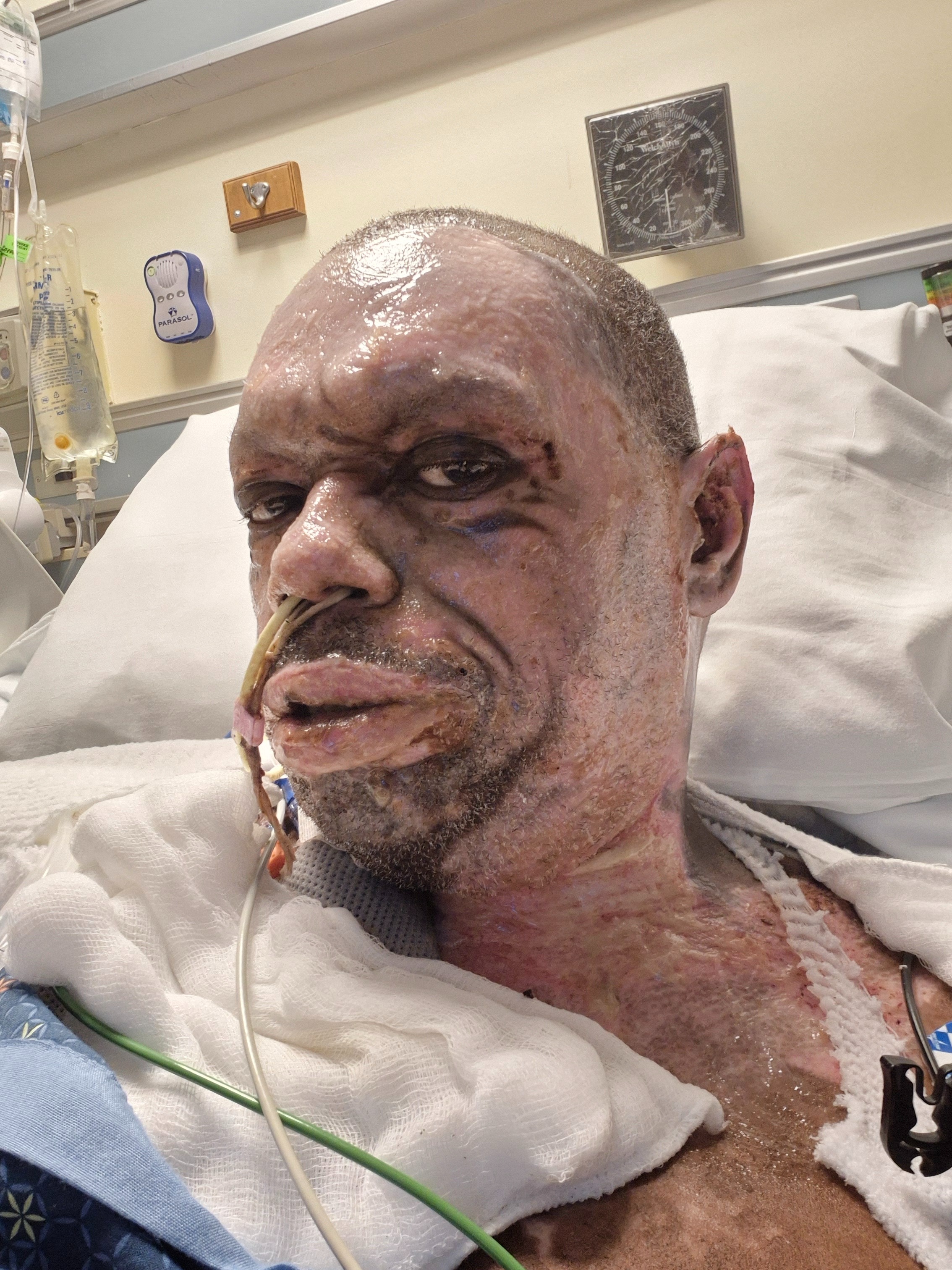 Support Floyd's Recovery After Restaurant Explosion campaign photo, 6 of 7