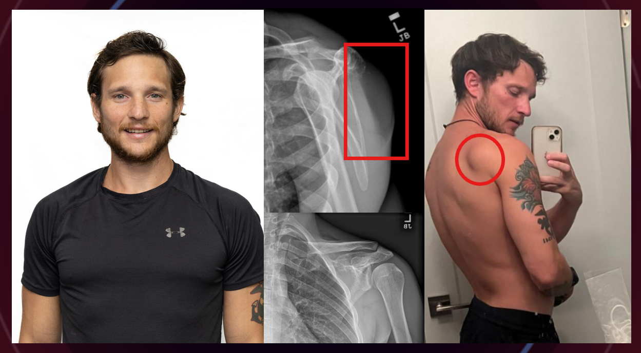 Support Coach Kyle Perry's Tumor Treatment campaign photo, 2 of 5