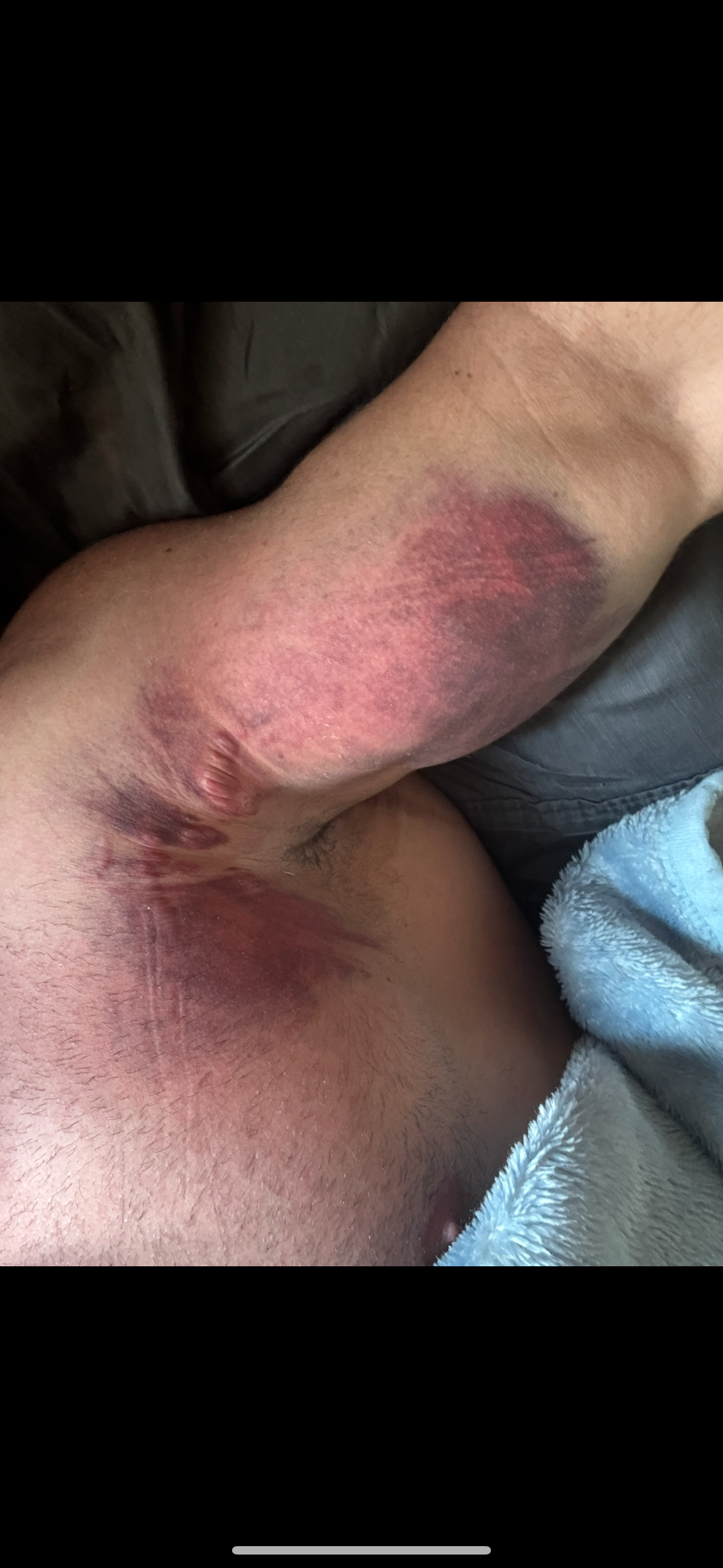 My expenses as I am not able to work due to injury! campaign photo, 5 of 6