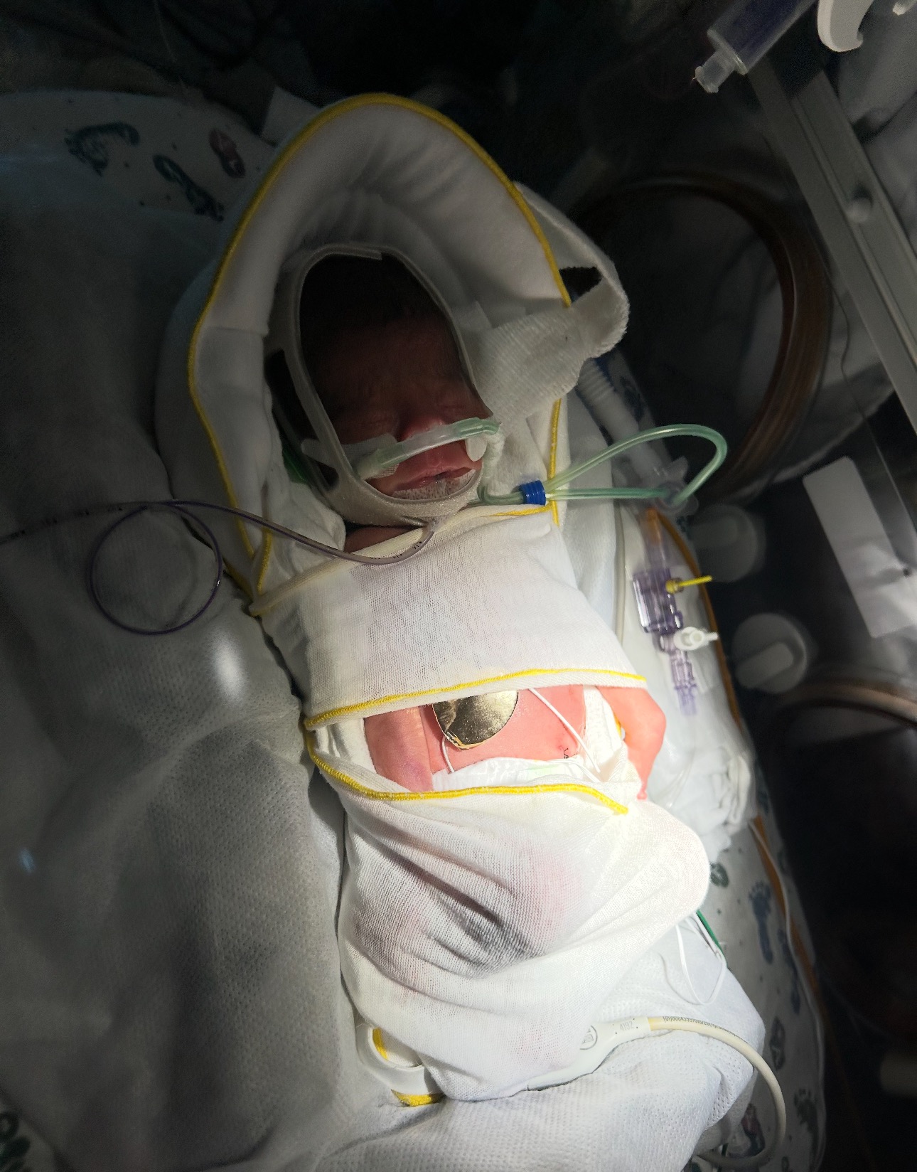 Aid Justin's Recovery and Twins born Prematurely campaign photo, 2 of 7