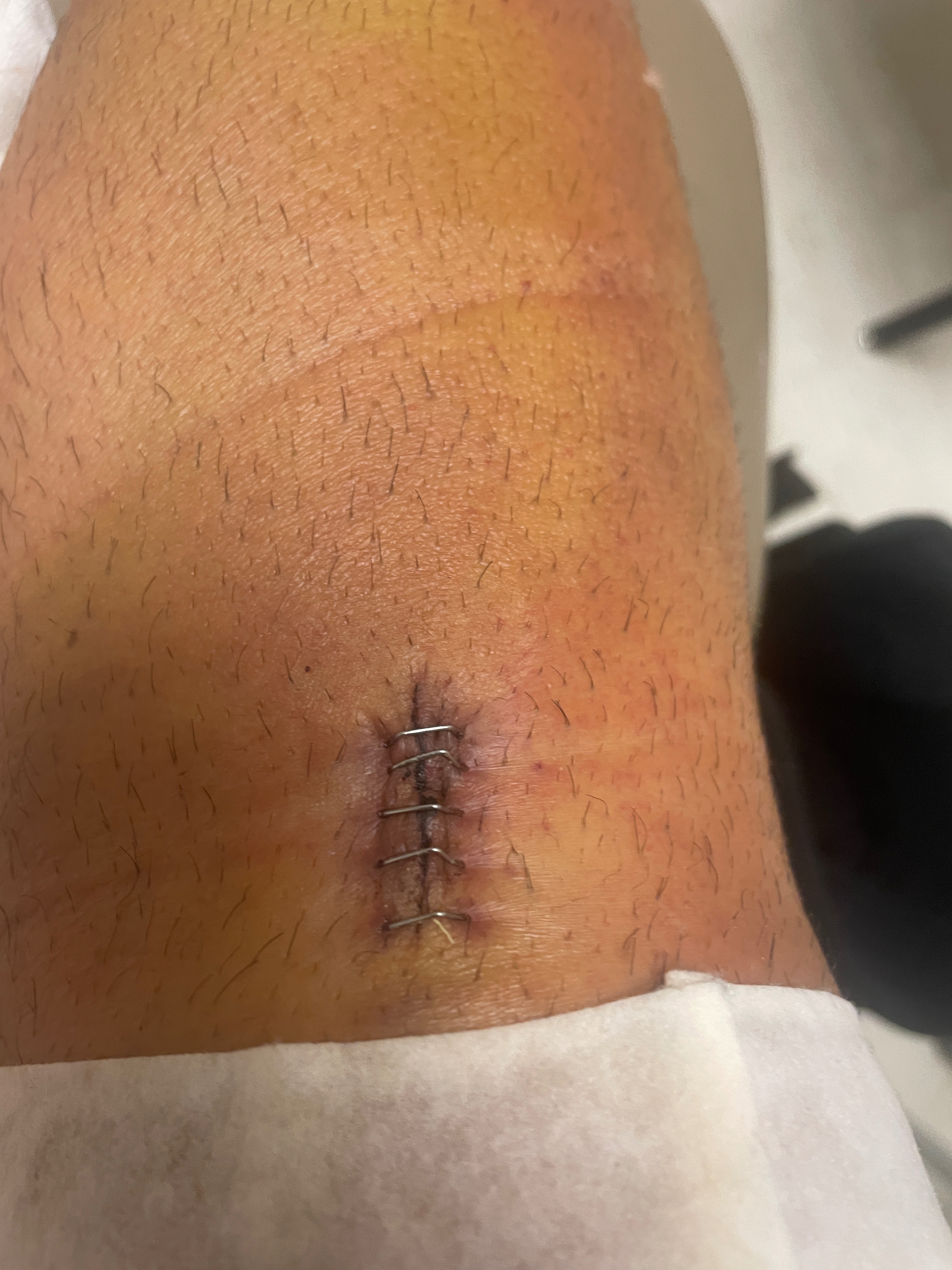 Support Colossal Mike Law's Surgery Recovery campaign photo, 2 of 8