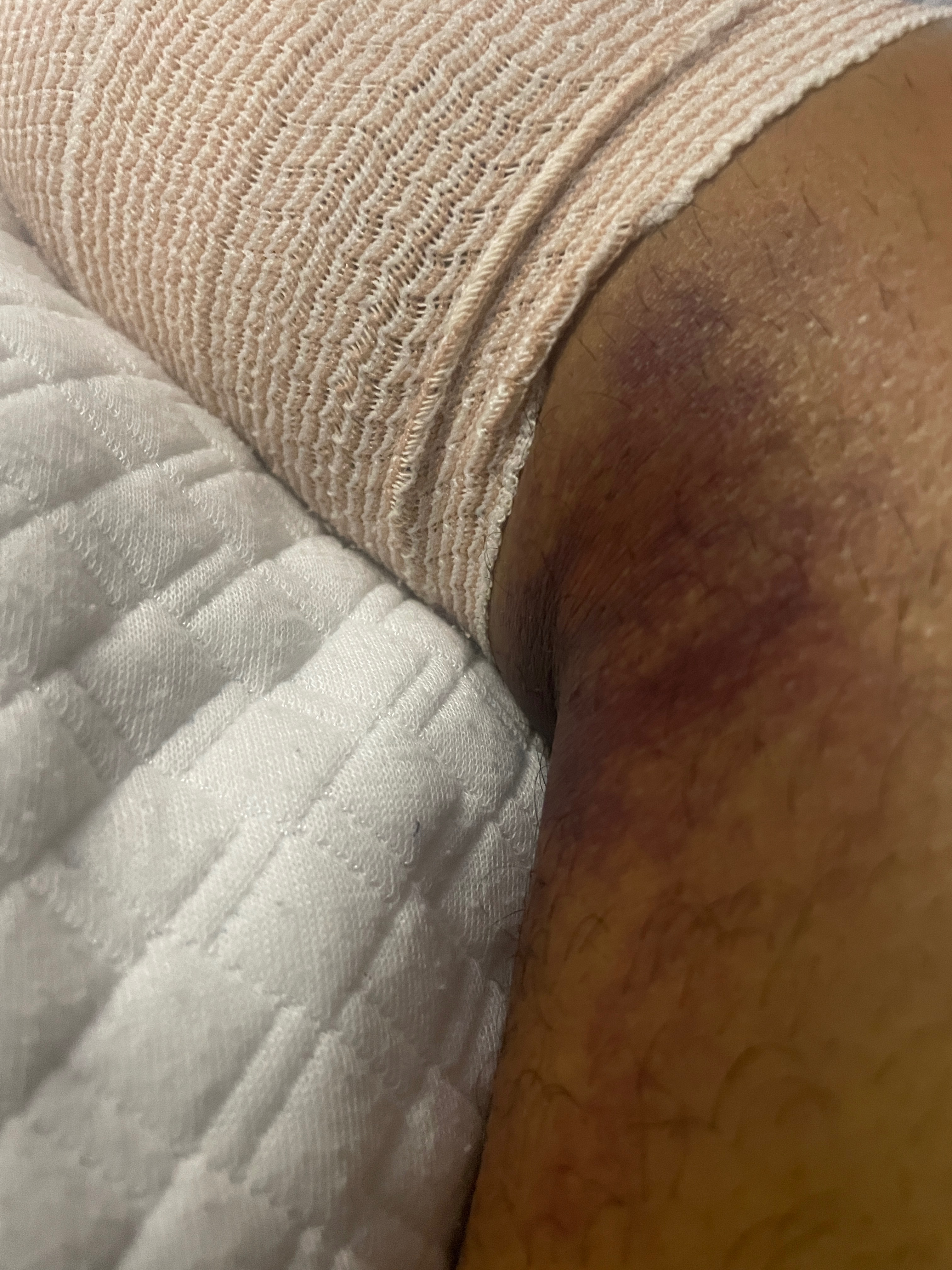 Support Colossal Mike Law's Surgery Recovery campaign photo, 5 of 8