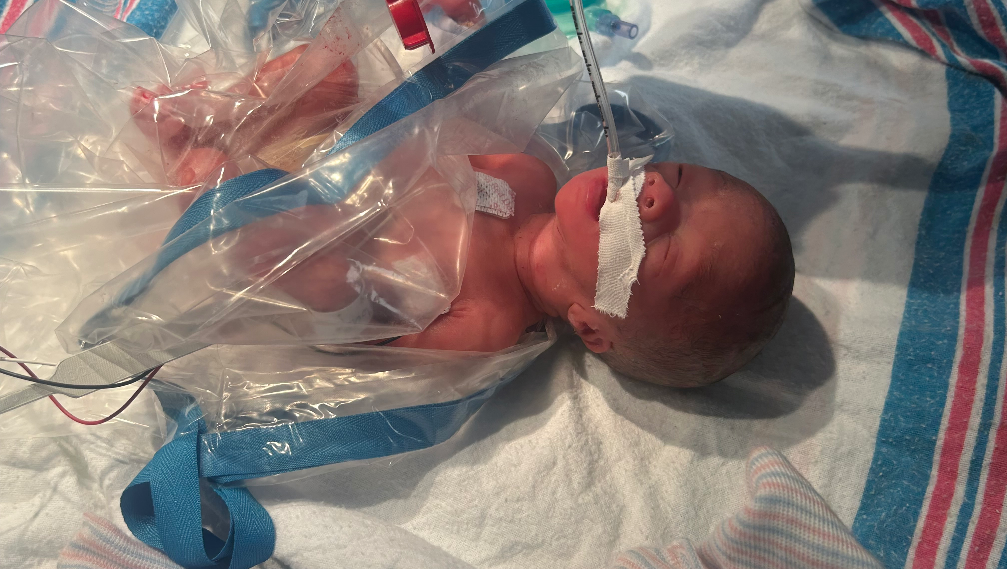 Support Mary Lee's Preemie Baby Journey photo