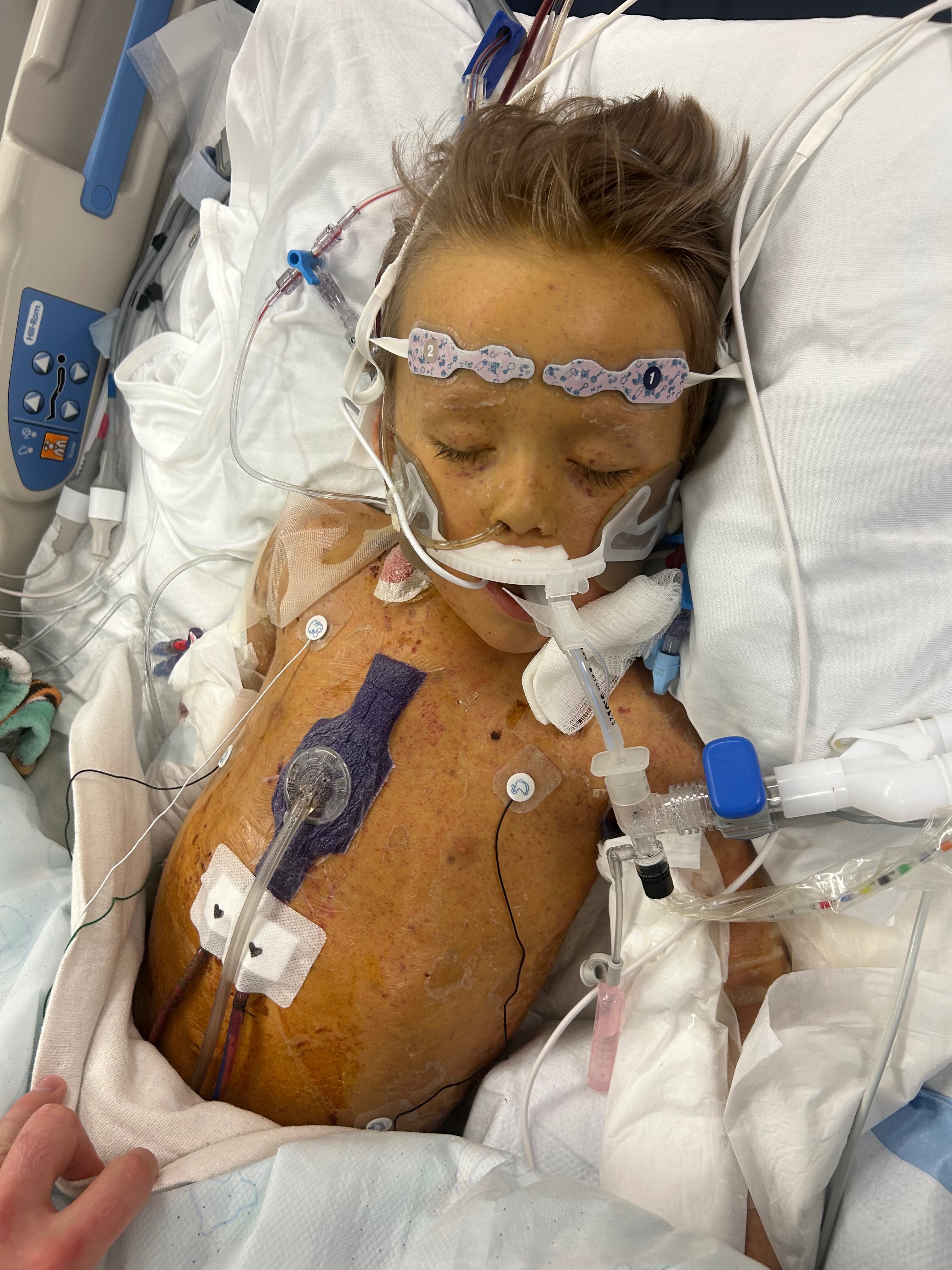 Help Blue Fight Life-Threatening Sepsis campaign photo, 6 of 7